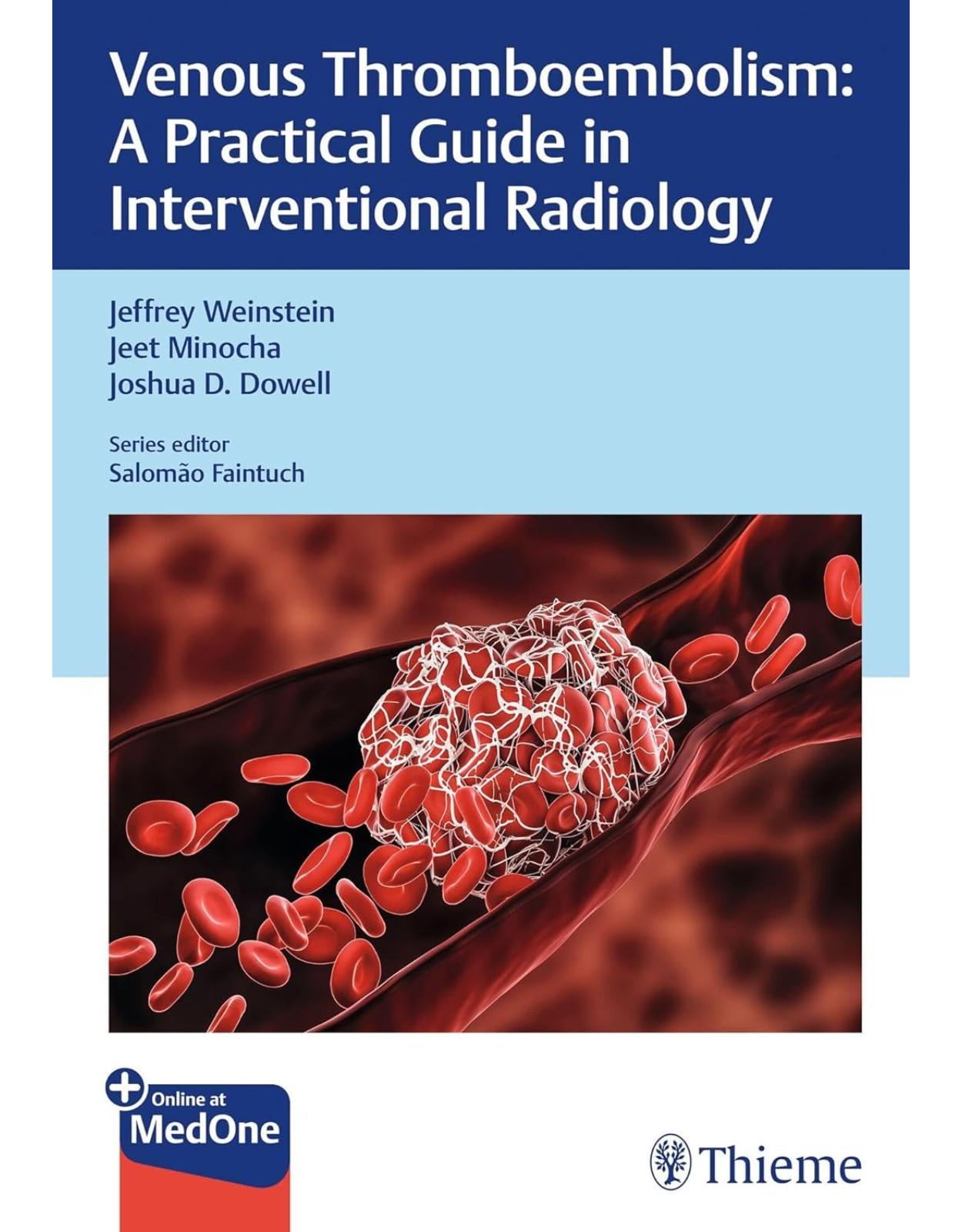 Venous Thromboembolism: A Practical Guide in Interventional Radiology