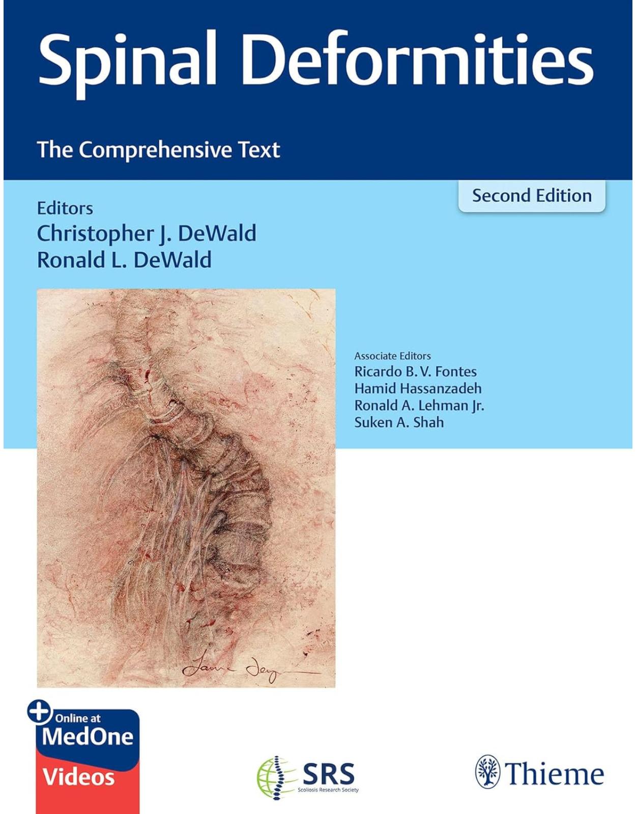 Spinal Deformities – The Comprehensive Text