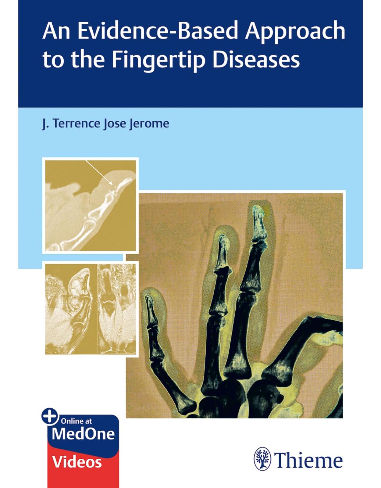 An Evidence-Based Approach to the Fingertip Diseases