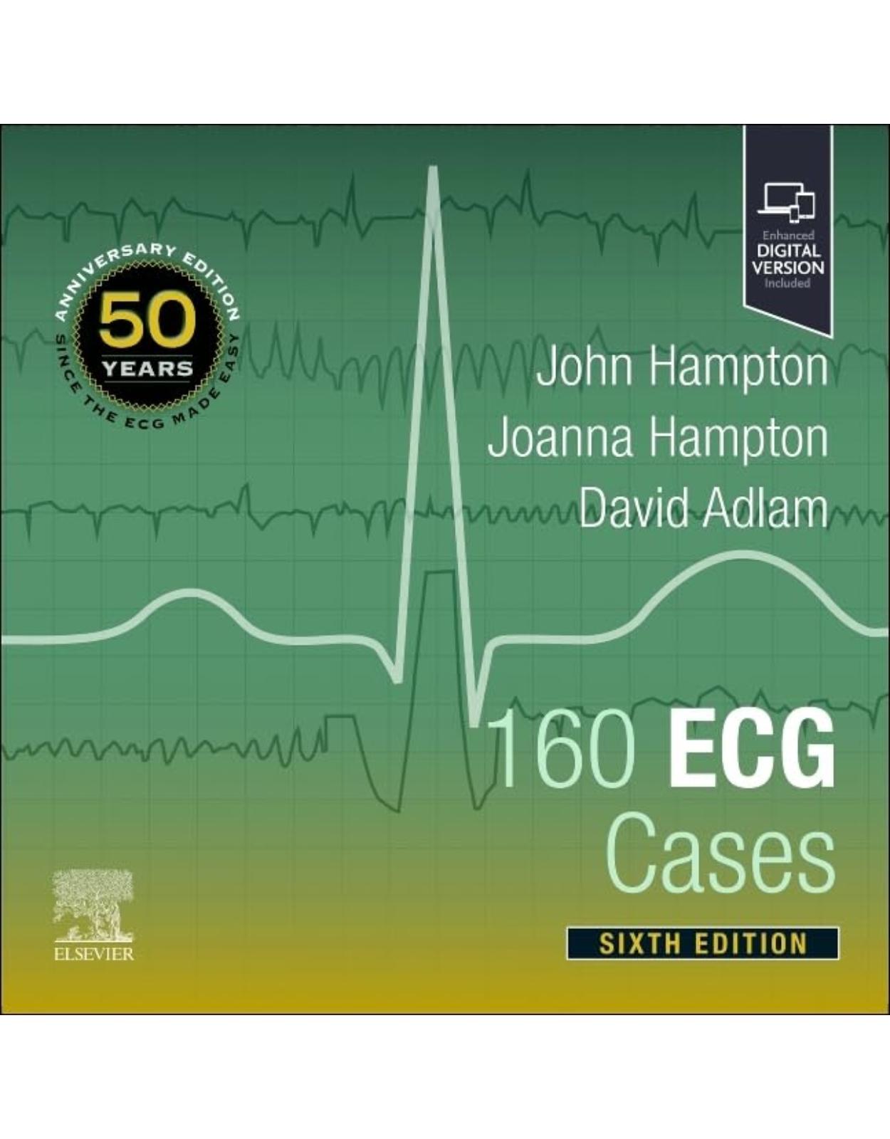 160 ECG Cases