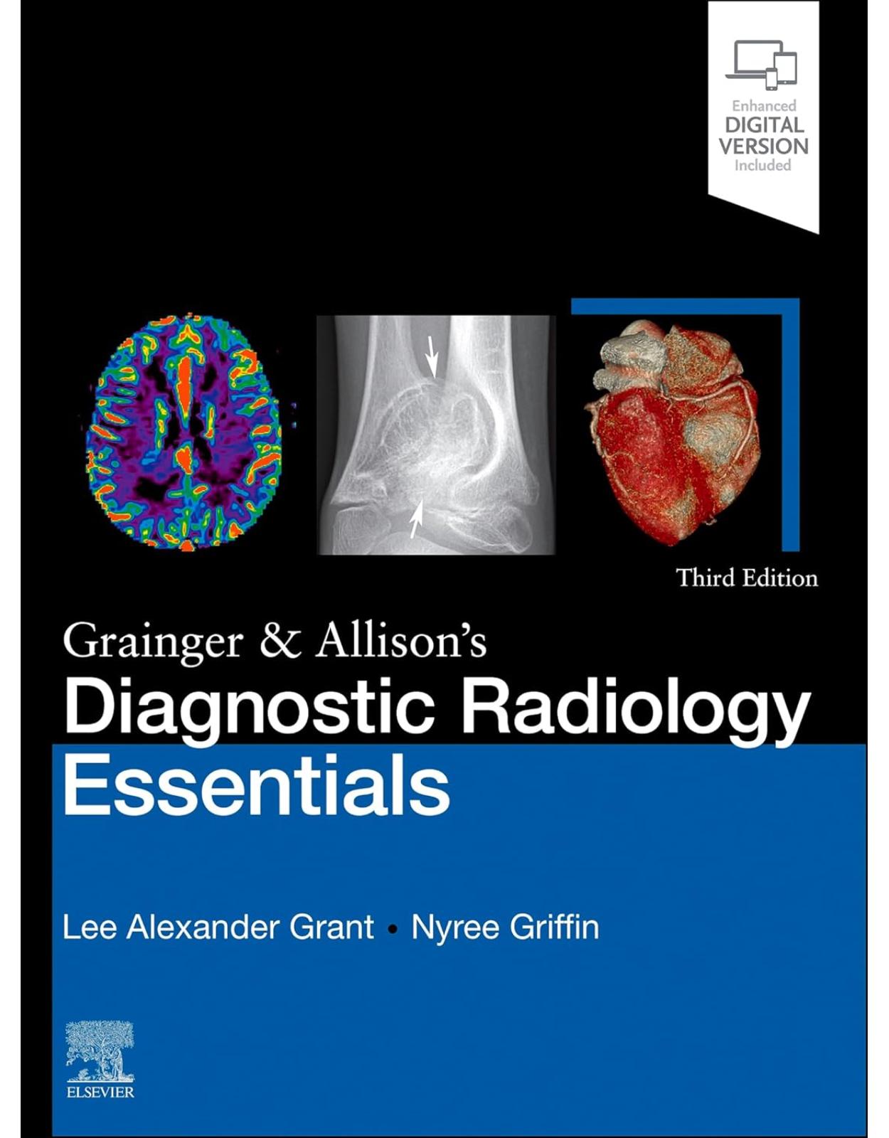 Grainger & Allison’s Diagnostic Radiology Essentials 