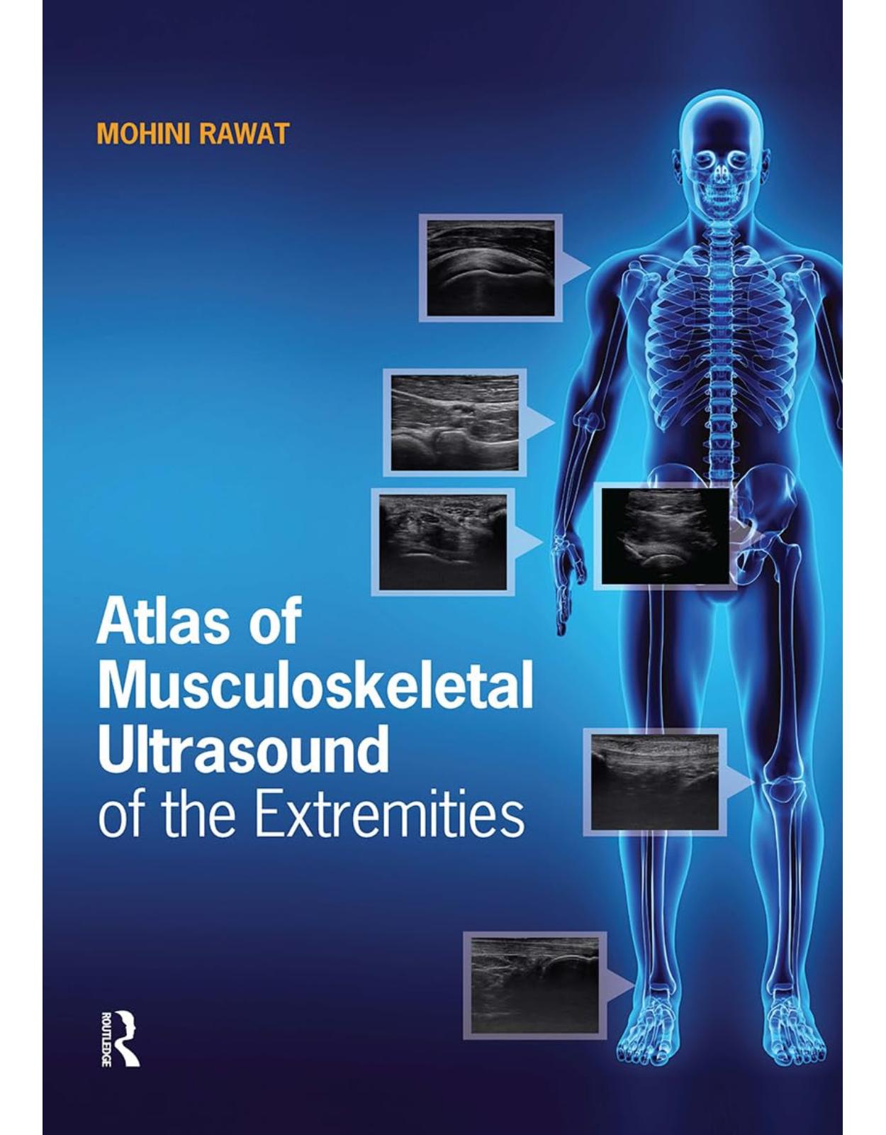 Atlas of Musculoskeletal Ultrasound of the Extremities 1st Edition