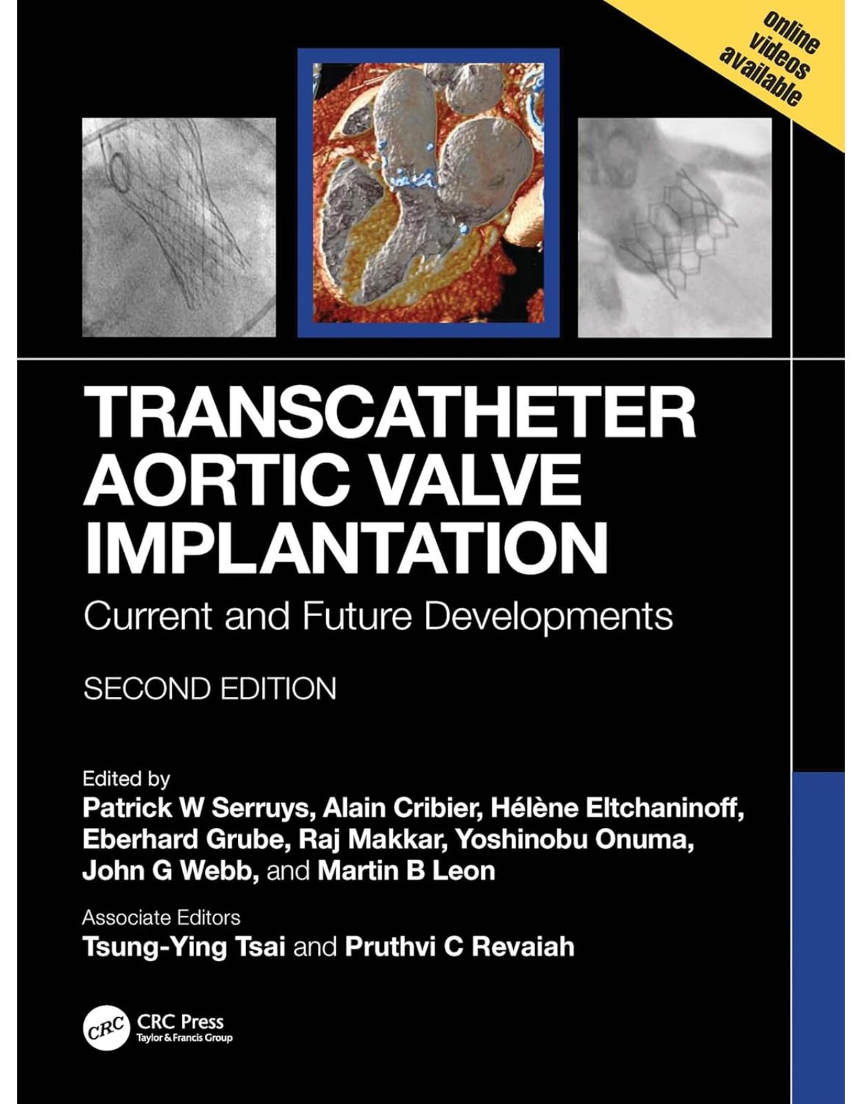 Transcatheter Aortic Valve Implantation: Current and Future Developments