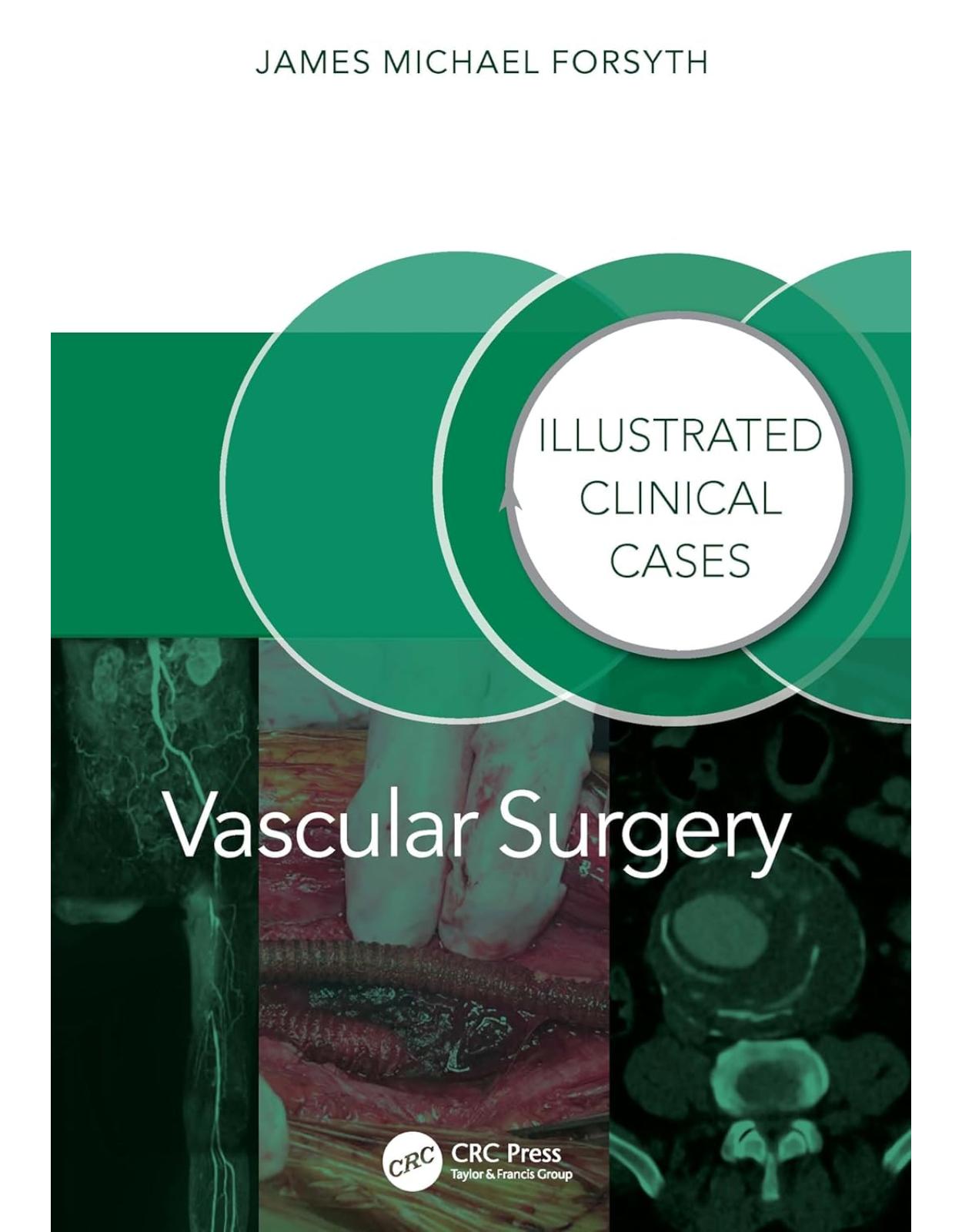 Vascular Surgery: Illustrated Clinical Cases