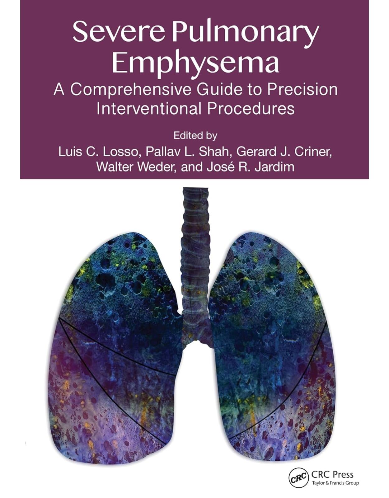 Severe Pulmonary Emphysema:: A Comprehensive Guide to Precision Interventional Procedures 