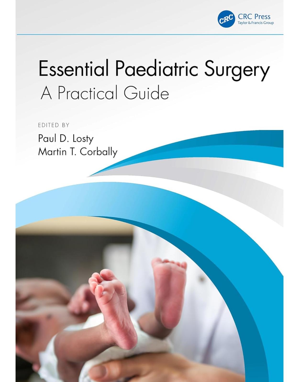 Essential Paediatric Surgery: A Practical Guide