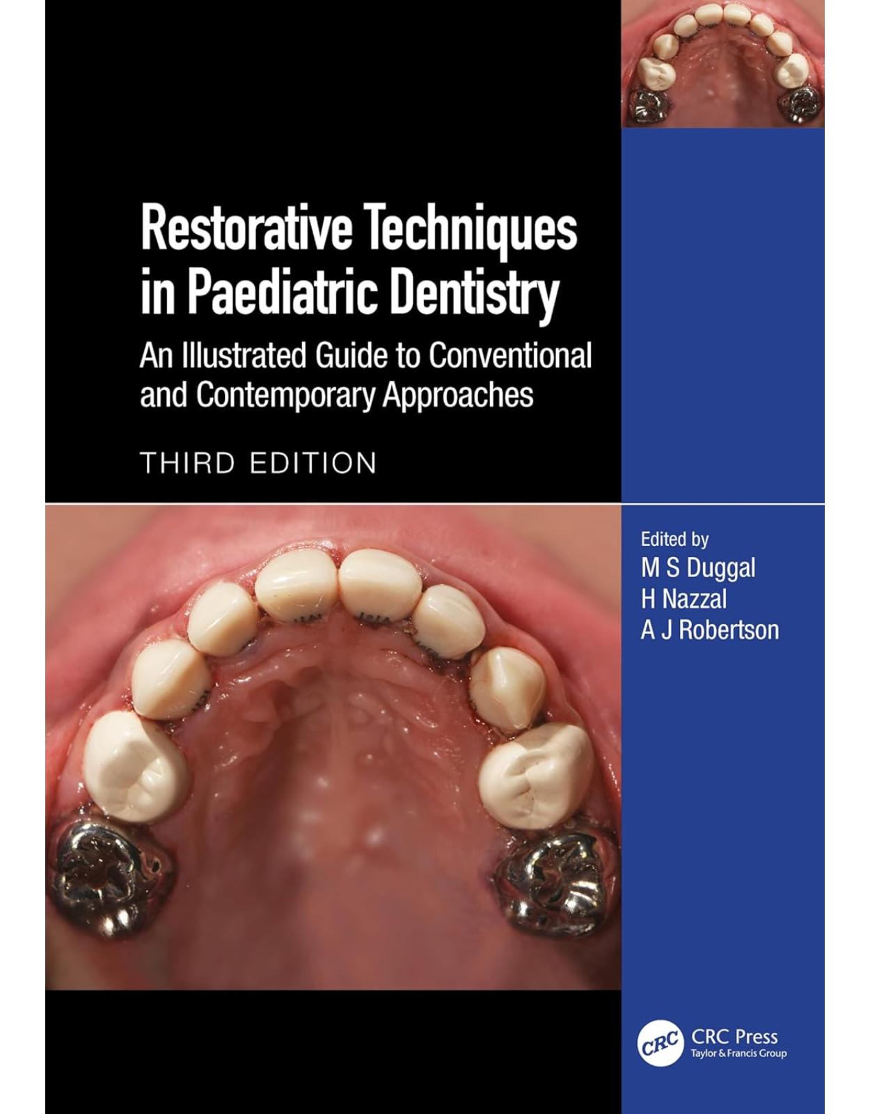 Restorative Techniques in Paediatric Dentistry: An Illustrated Guide to Conventional and Contemporary Approaches