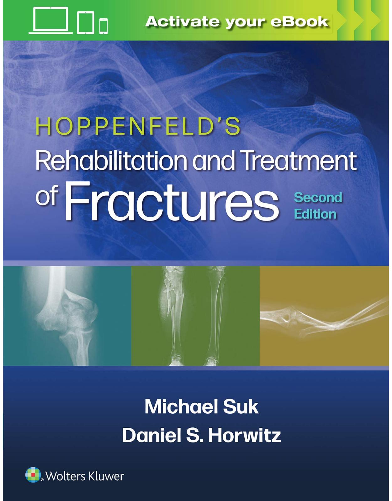 Hoppenfeld’s Treatment and Rehabilitation of Fractures