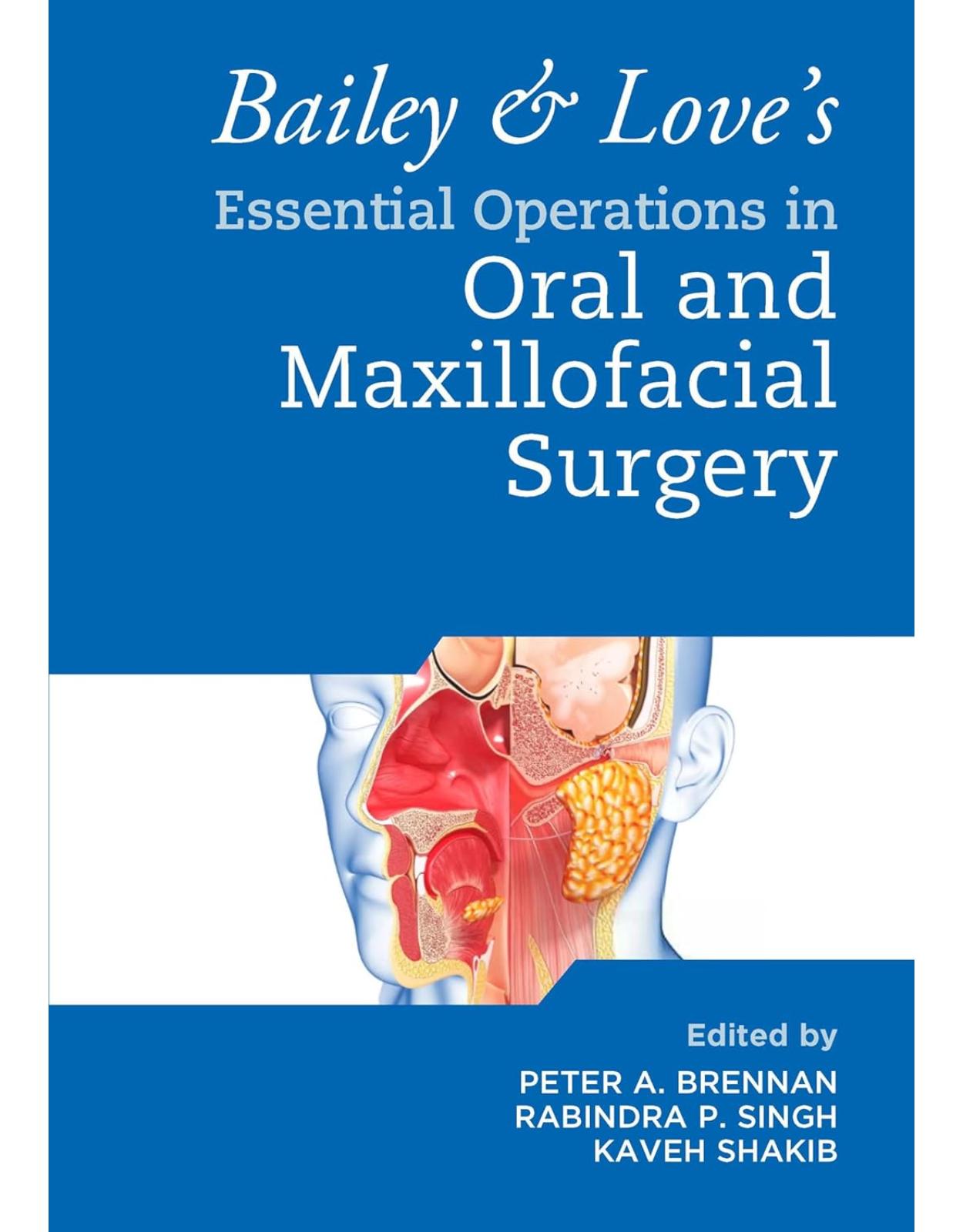 Bailey & Love’s Essential Operations in Oral & Maxillofacial Surgery