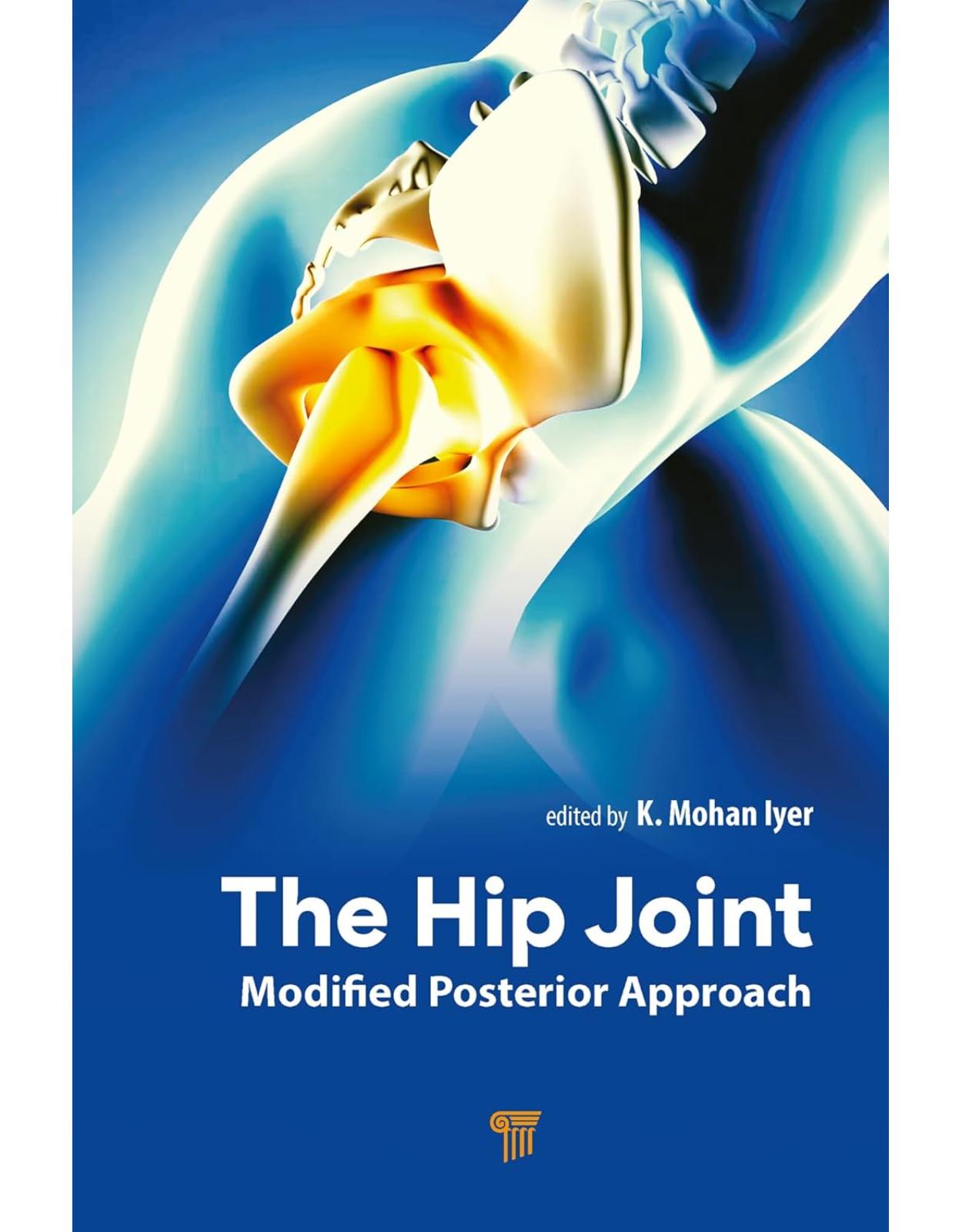 The Hip Joint: Modified Posterior Approach