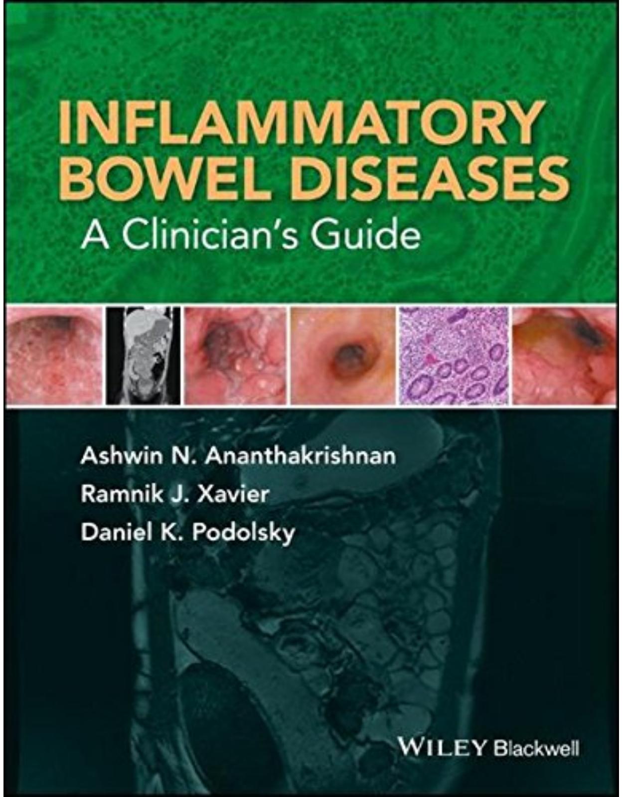 Inflammatory Bowel Diseases: A Clinician’s Guide