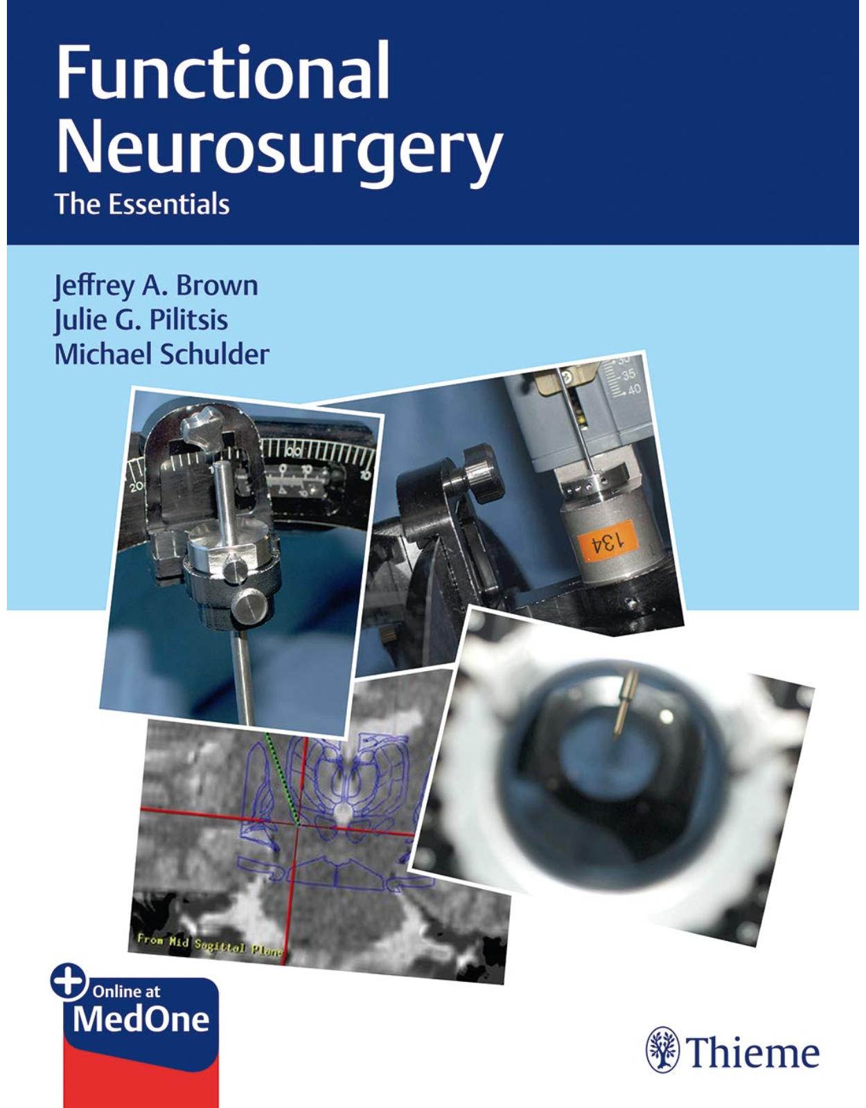 Functional Neurosurgery: The Essentials