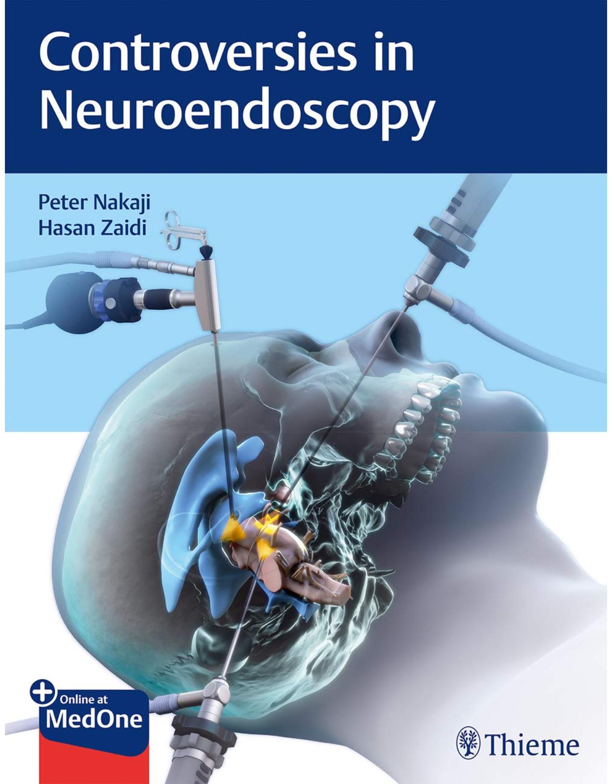 Controversies in Neuroendoscopy 