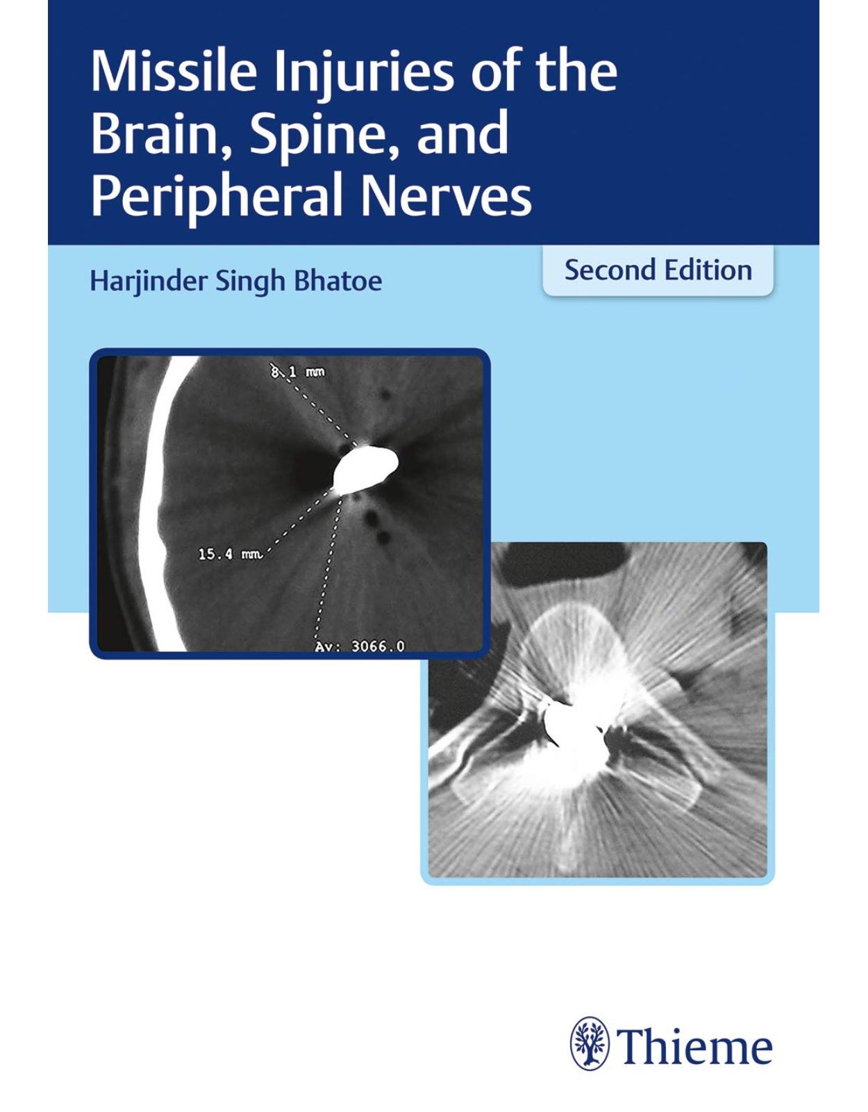 Missile Injuries of the Brain, Spine, and Peripheral Nerves