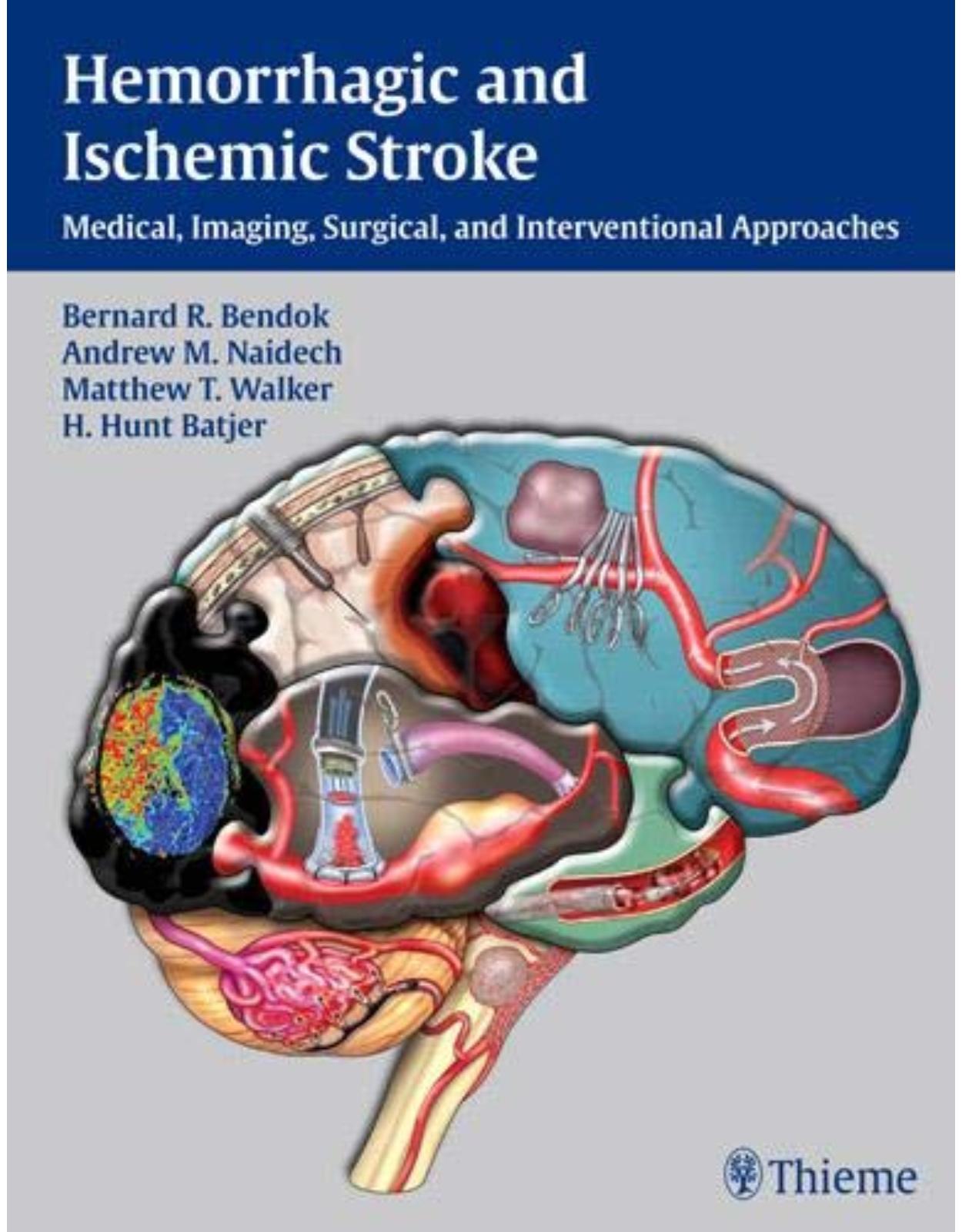 Hemorrhagic and Ischemic Stroke: Medical, Imaging, Surgical and Interventional Approaches 