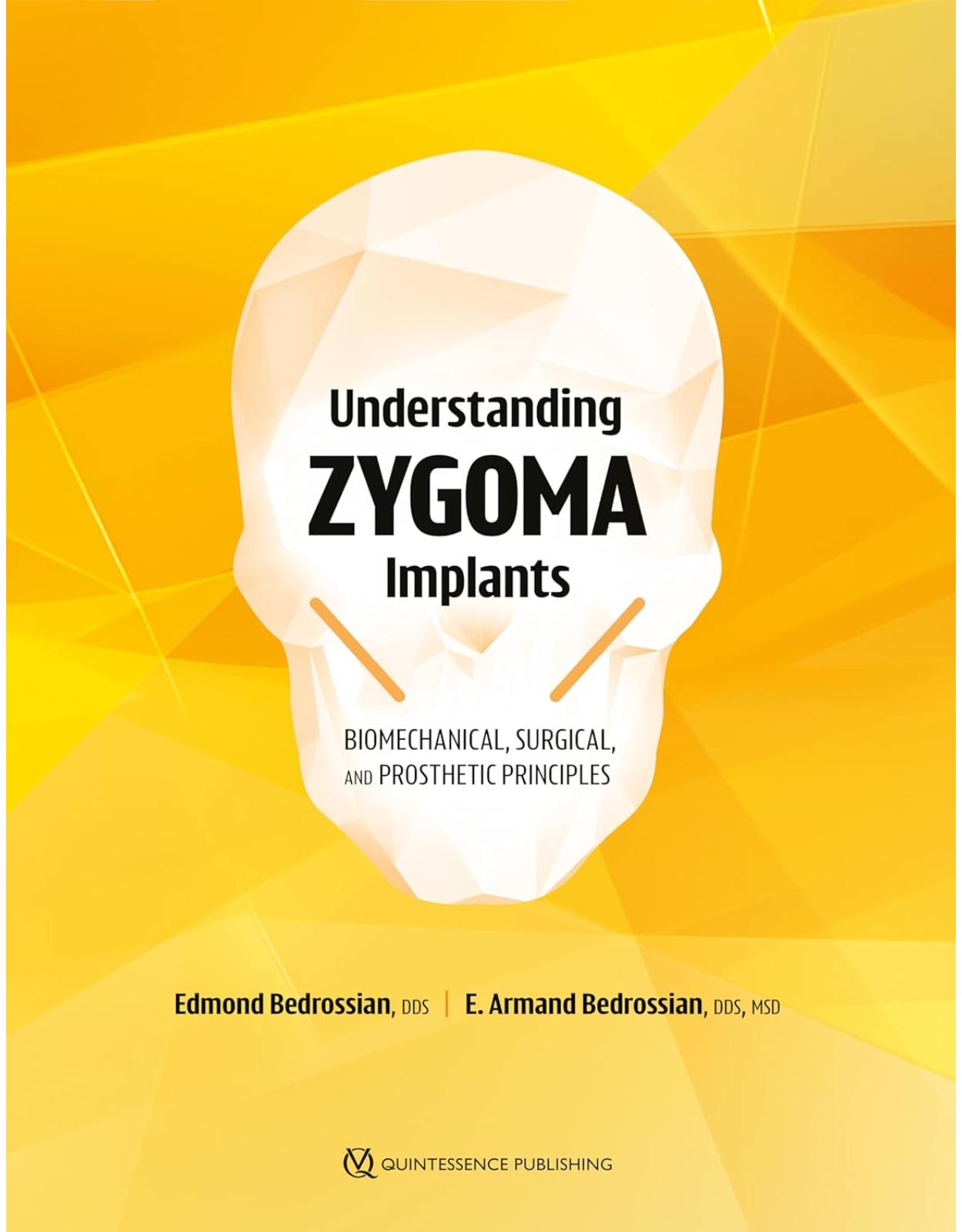 Understanding Zygoma Implants: Biomechanical, Surgical, and Prosthetic Principles