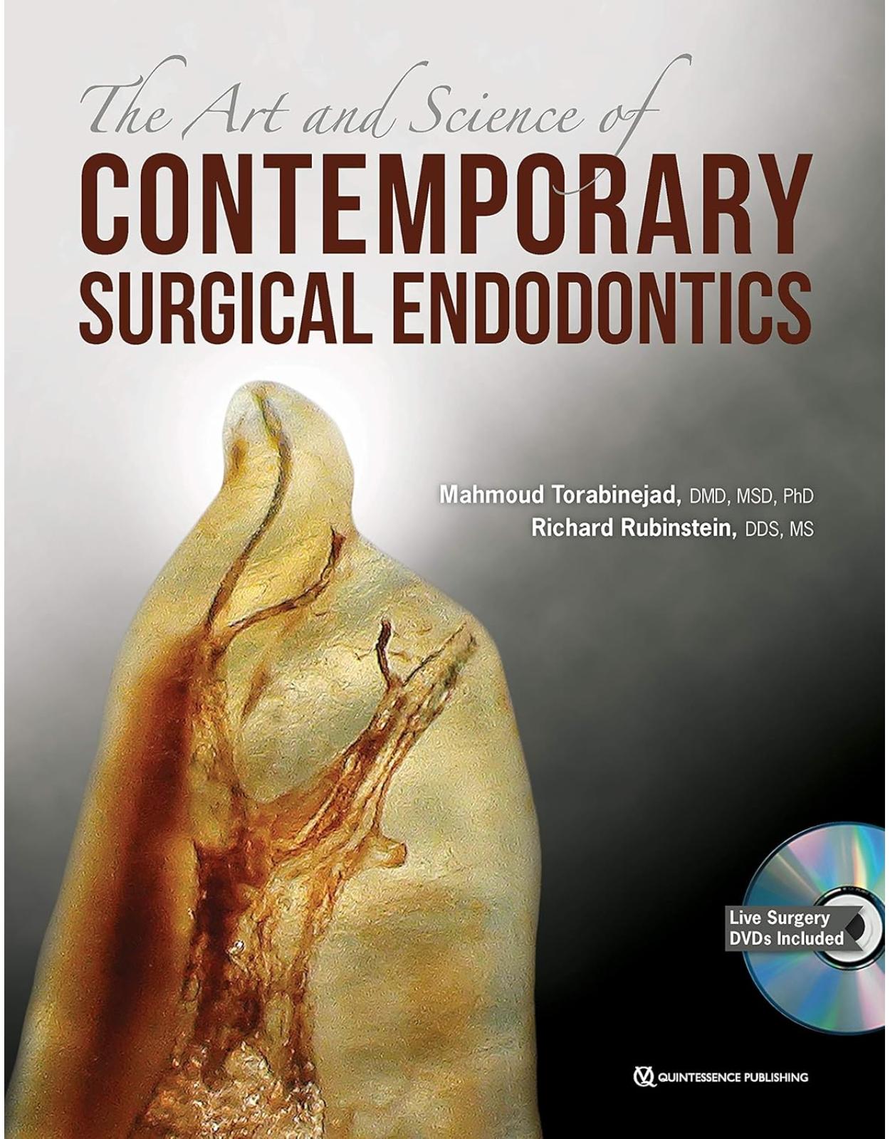 The Art and Science of Contemporary Surgical Endodontics