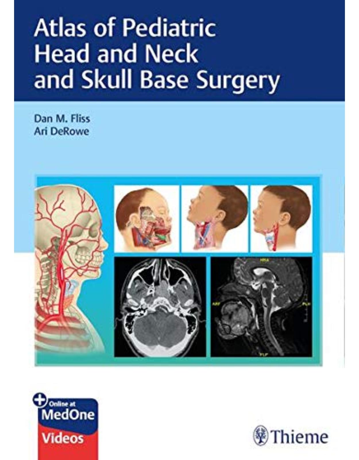 Atlas of Pediatric Head and Neck and Skull Base Surgery