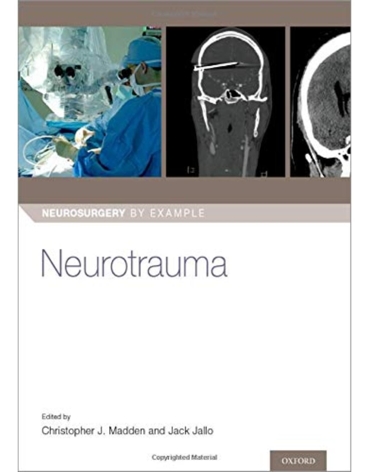 Neurotrauma (Neurosurgery by Example)