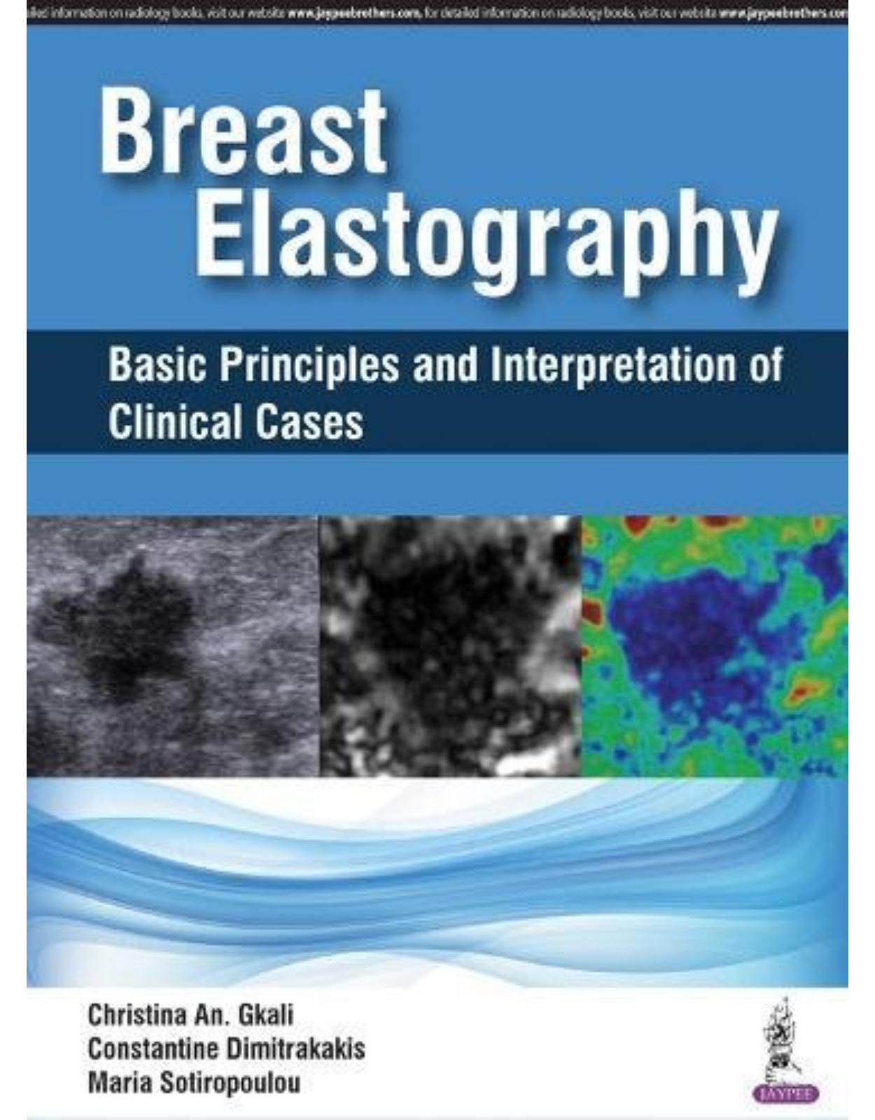 Breast Elastography: Basic Principles and Interpretation of Clinical Cases