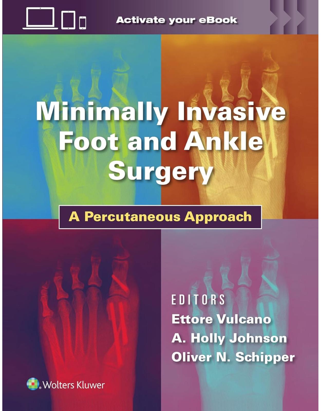 Minimally Invasive Foot and Ankle Surgery: A Percutaneous Approach