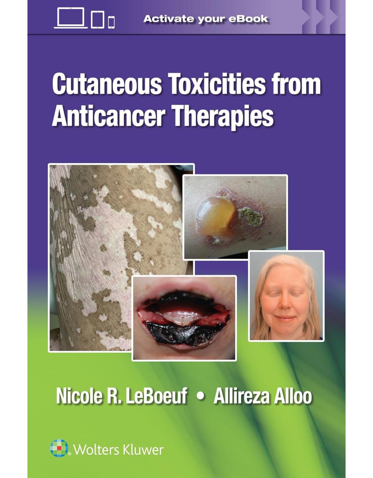 Cutaneous Reactions from Anti-Cancer Therapies