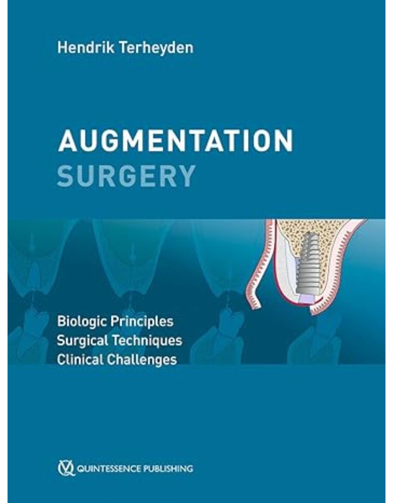 Augmentation Surgery: Biologic Principles - Surgical Techniques - Clinical Challenges,1st Edition