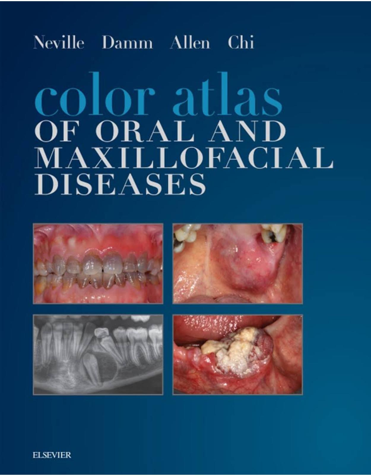 Color Atlas of Oral and Maxillofacial Diseases, 1e