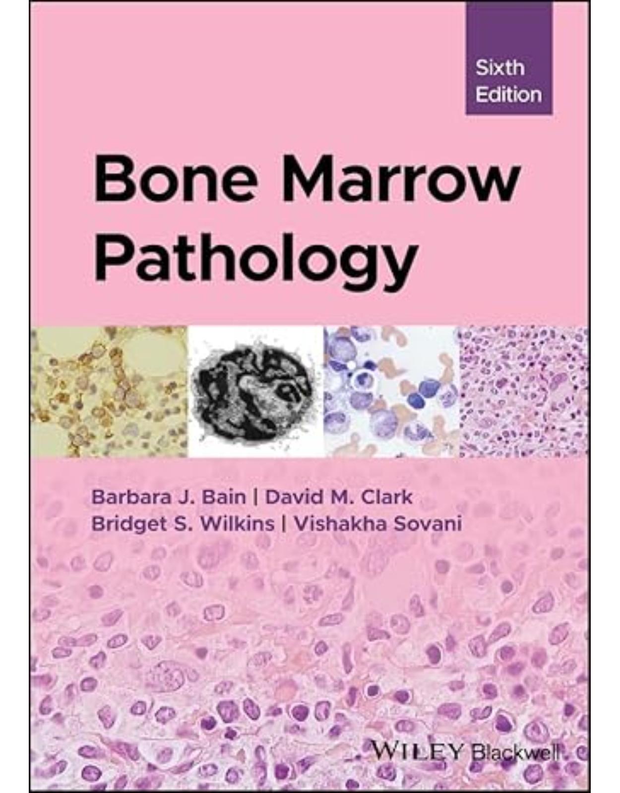 Bone Marrow Pathology 