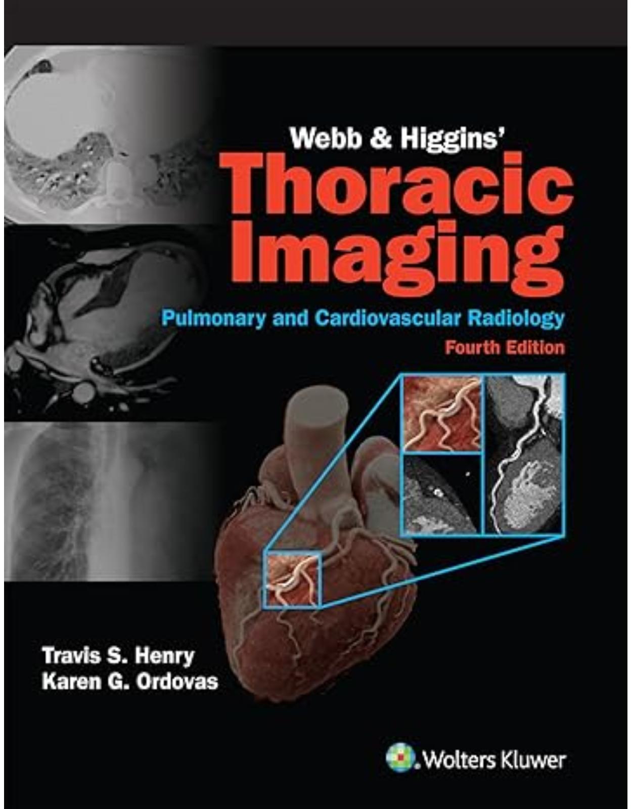 Webb & Higgins Thoracic Imaging:  Print + Digital with Multimedia