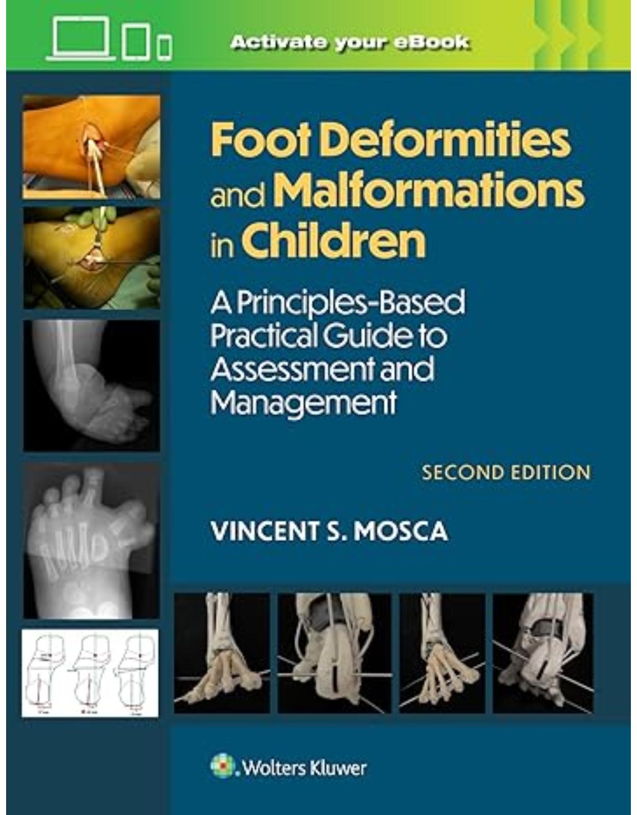 Foot Deformities and Malformations in Children: A Principles-Based, Practical Guide to Assessment and Management: