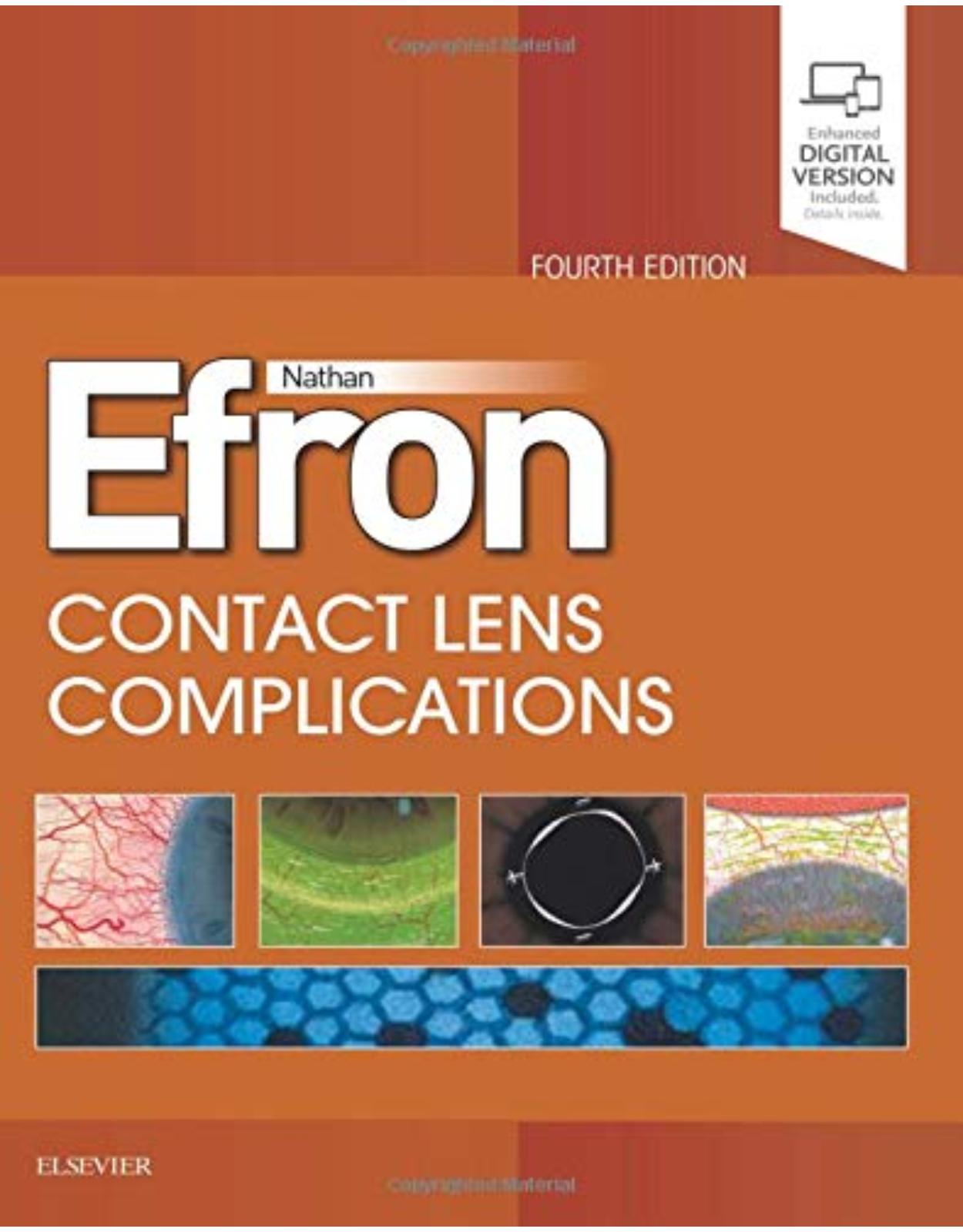 Contact Lens Complications, 4e: Expert Consult - Online and Print