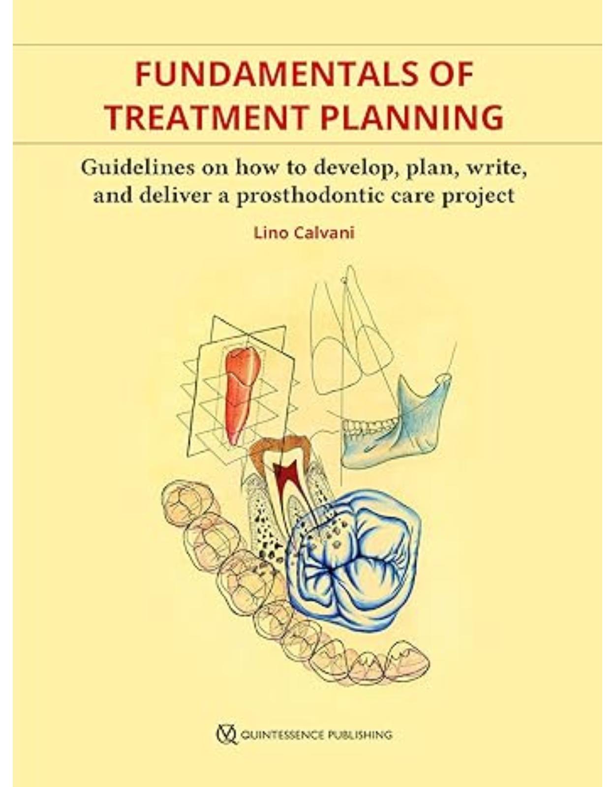 Fundamentals of Treatment Planning