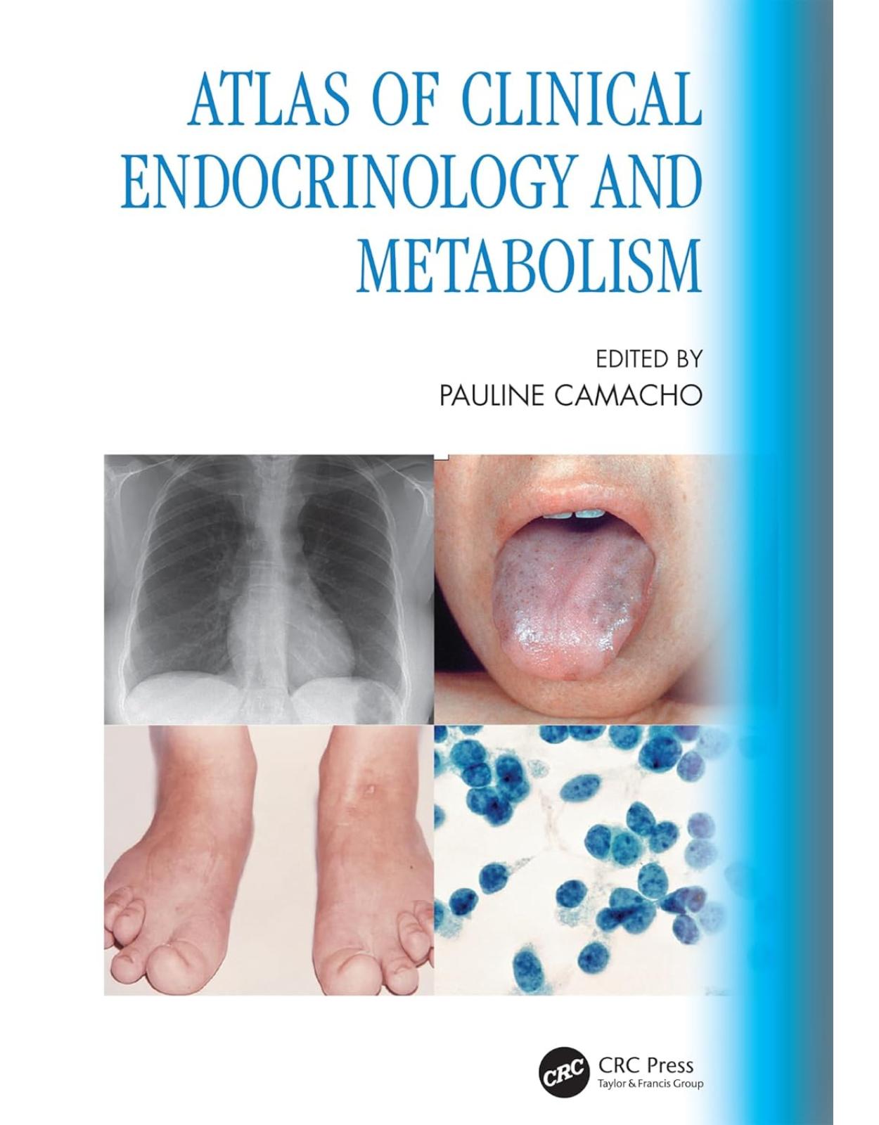 Atlas of Clinical Endocrinology and Metabolism