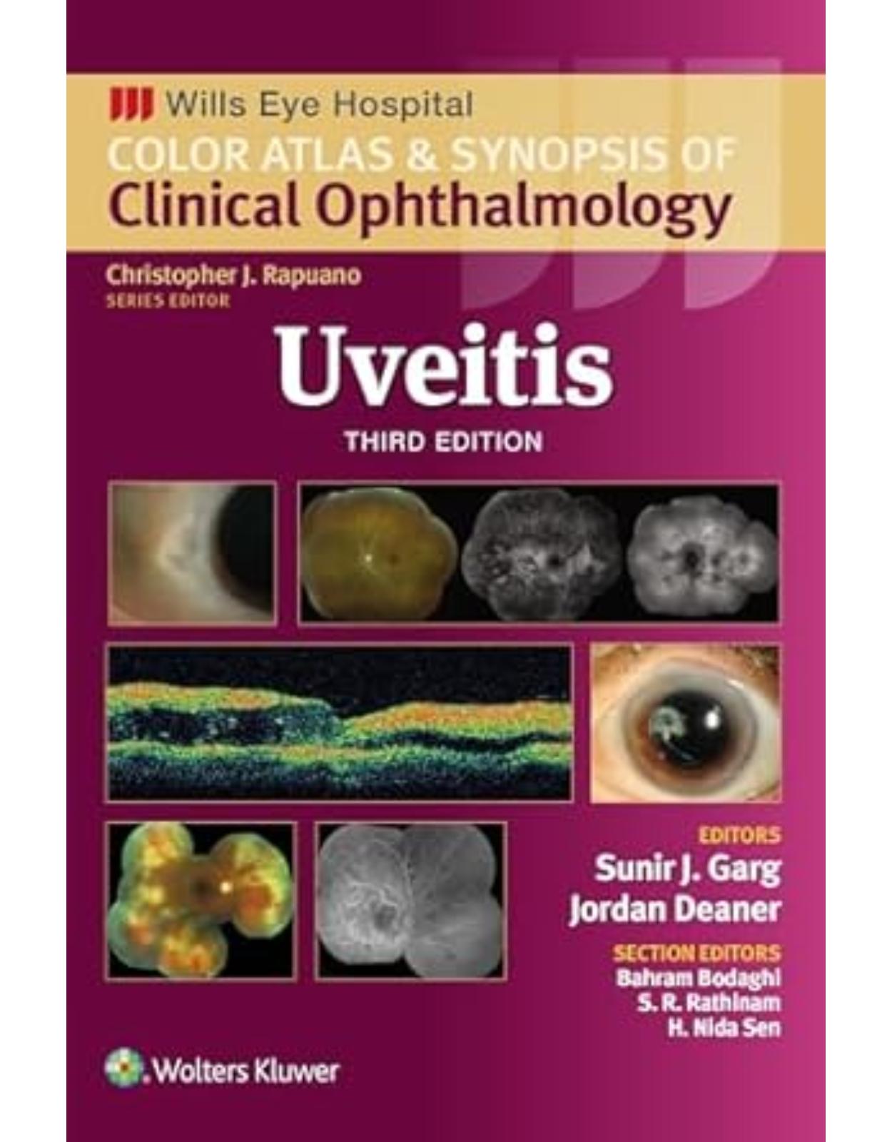 Uveitis. Third edition