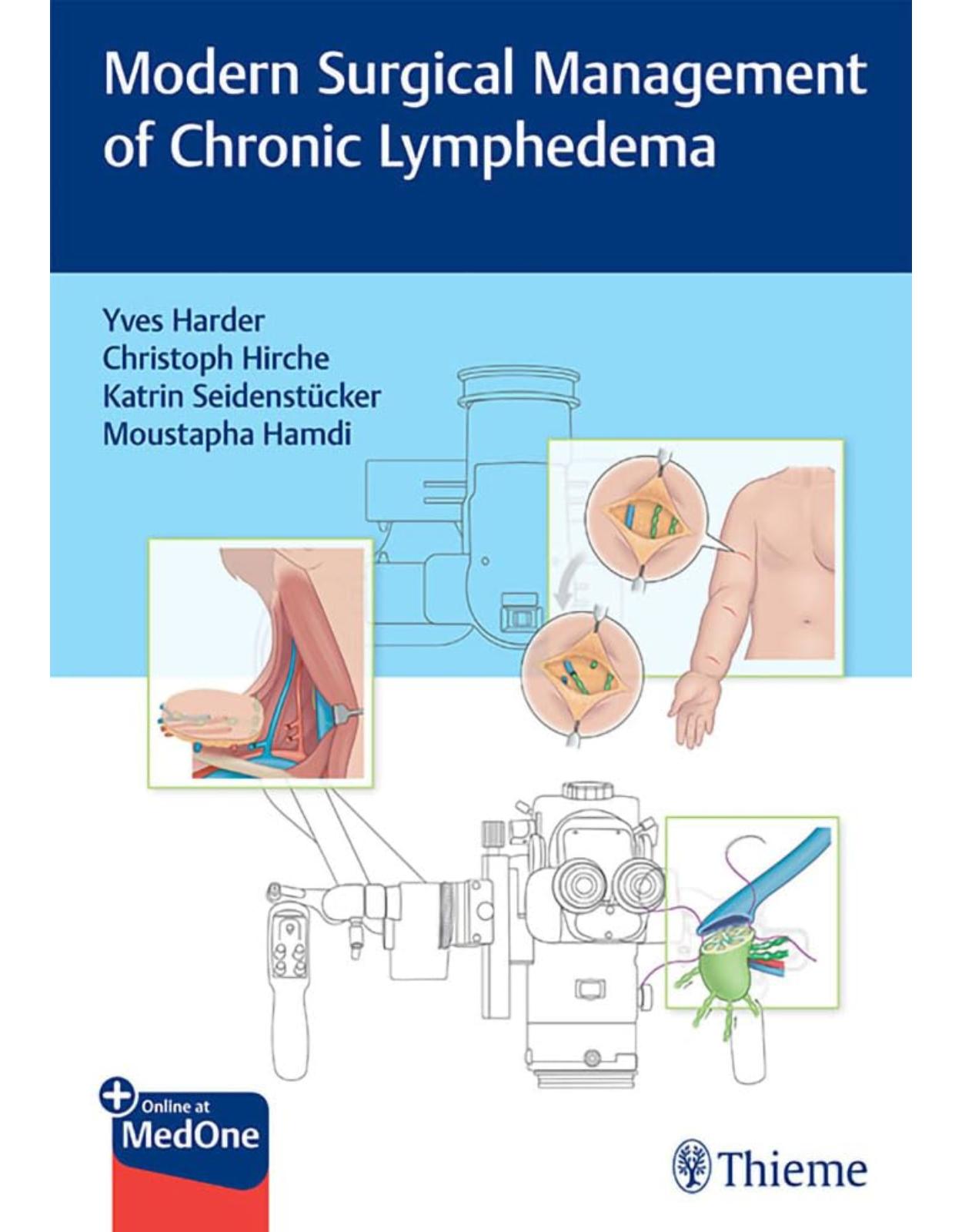 Modern Surgical Management of Chronic Lymphedema 