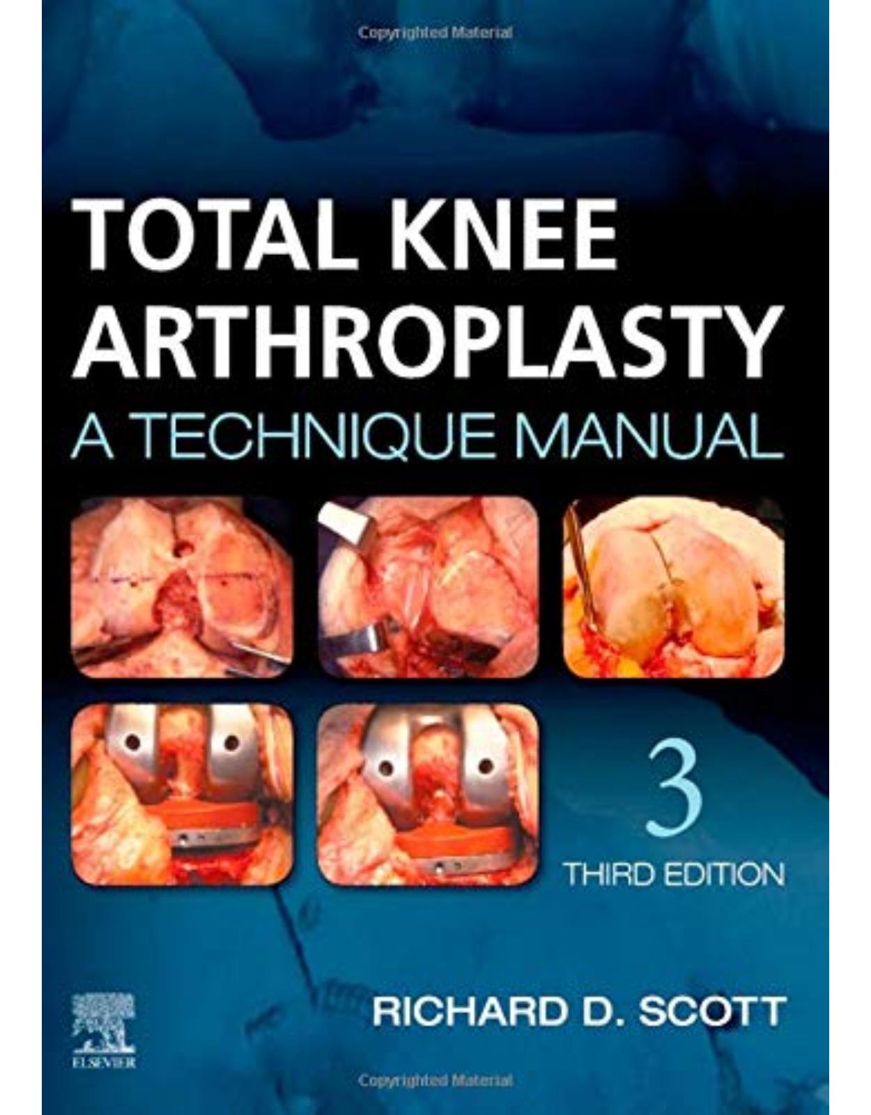 Total Knee Arthroplasty, 3rd Edition