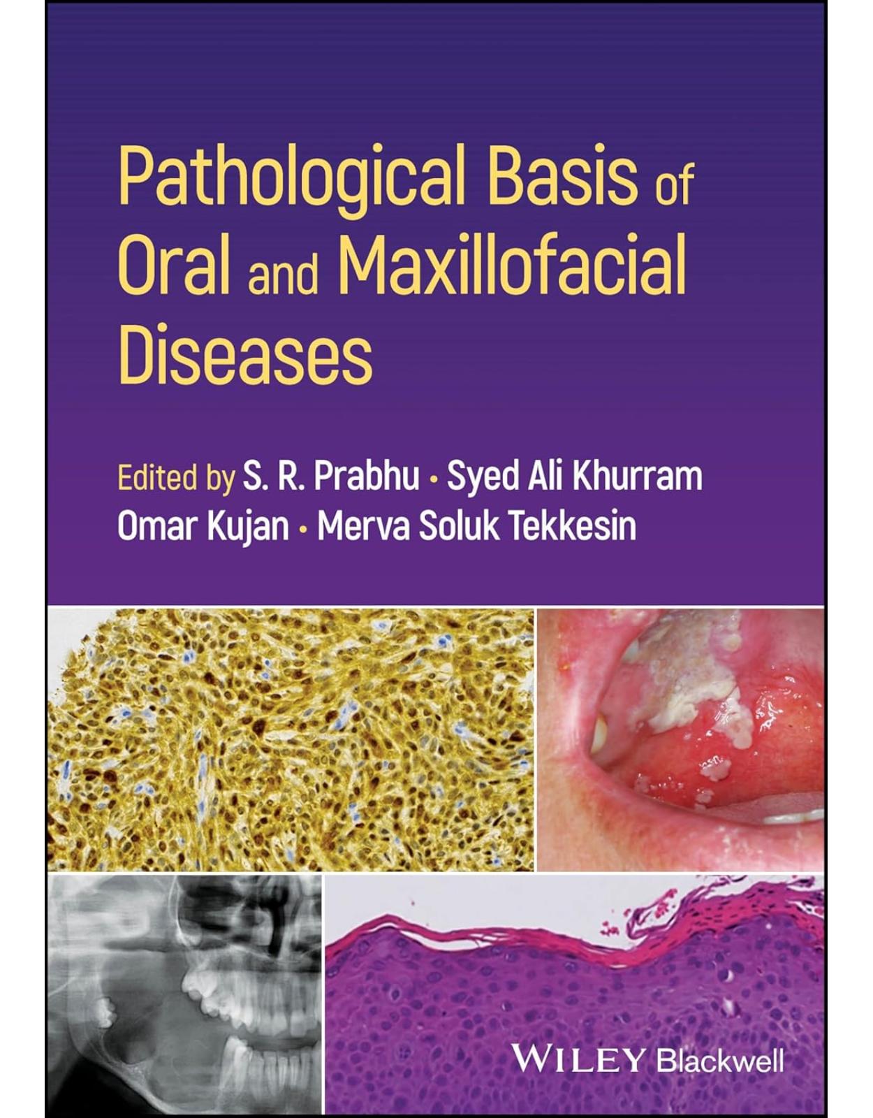 Pathological Basis of Oral and Maxillofacial Diseases