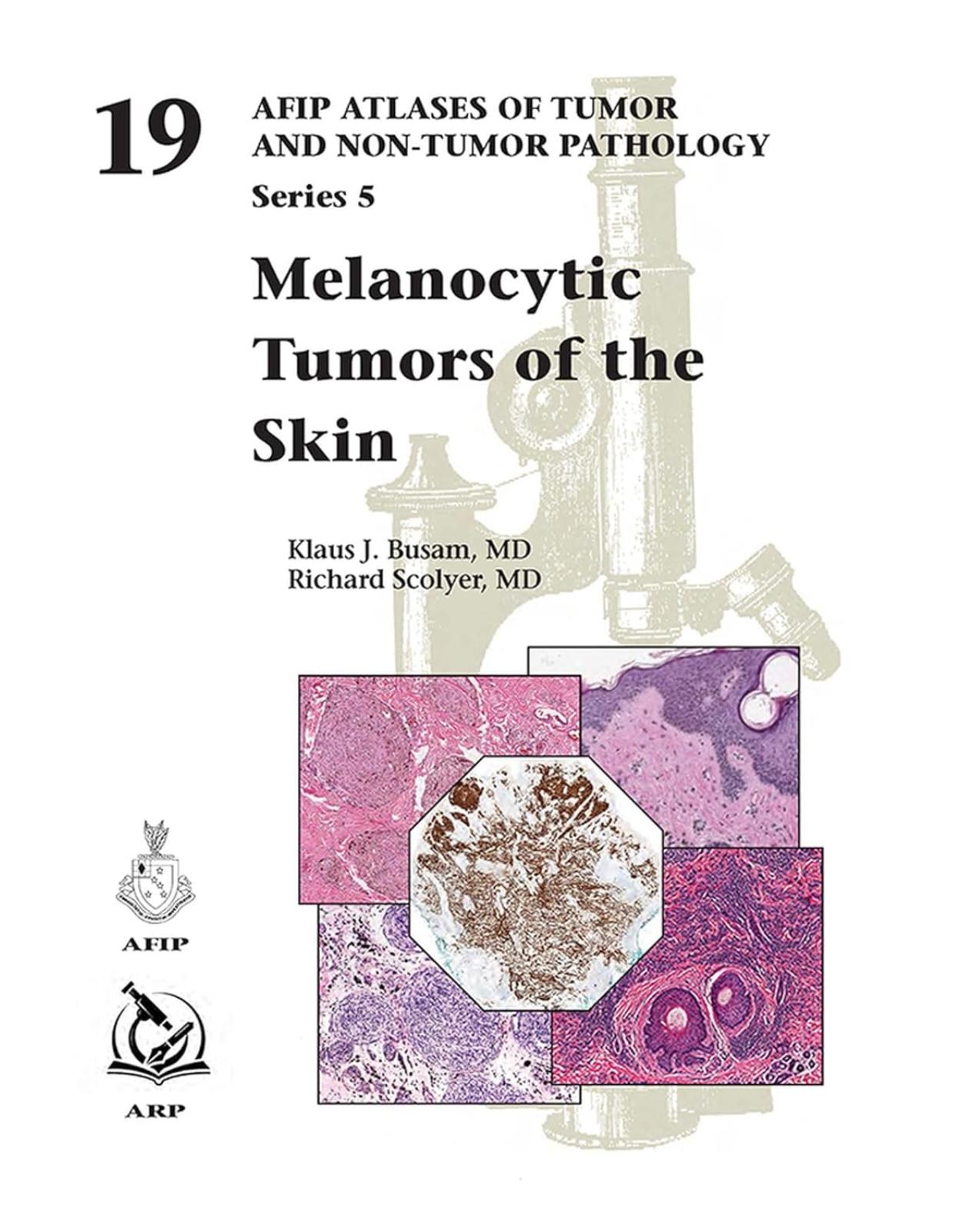 Melanocytic Tumors of the Skin. AFIP Atlases of Tumor and Non-Tumor Pathology, Series 5