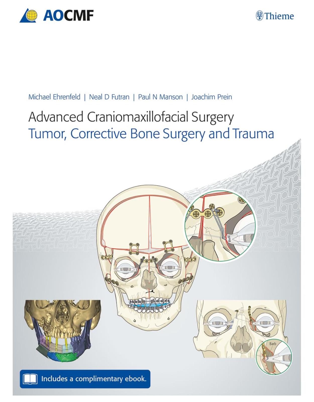 Advanced Craniomaxillofacial Surgery: Tumor, Corrective Bone Surgery, and Trauma