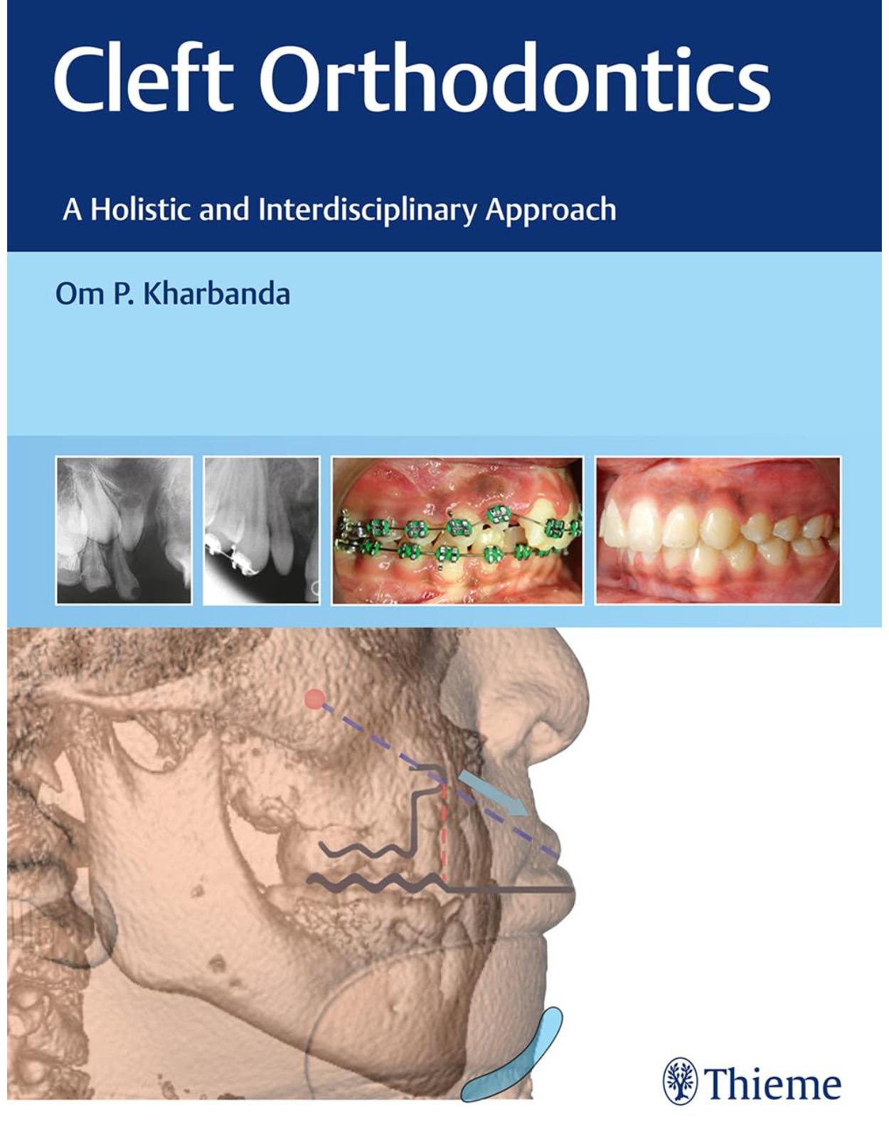 Cleft Orthodontics: A Holistic and Interdisciplinary Approach