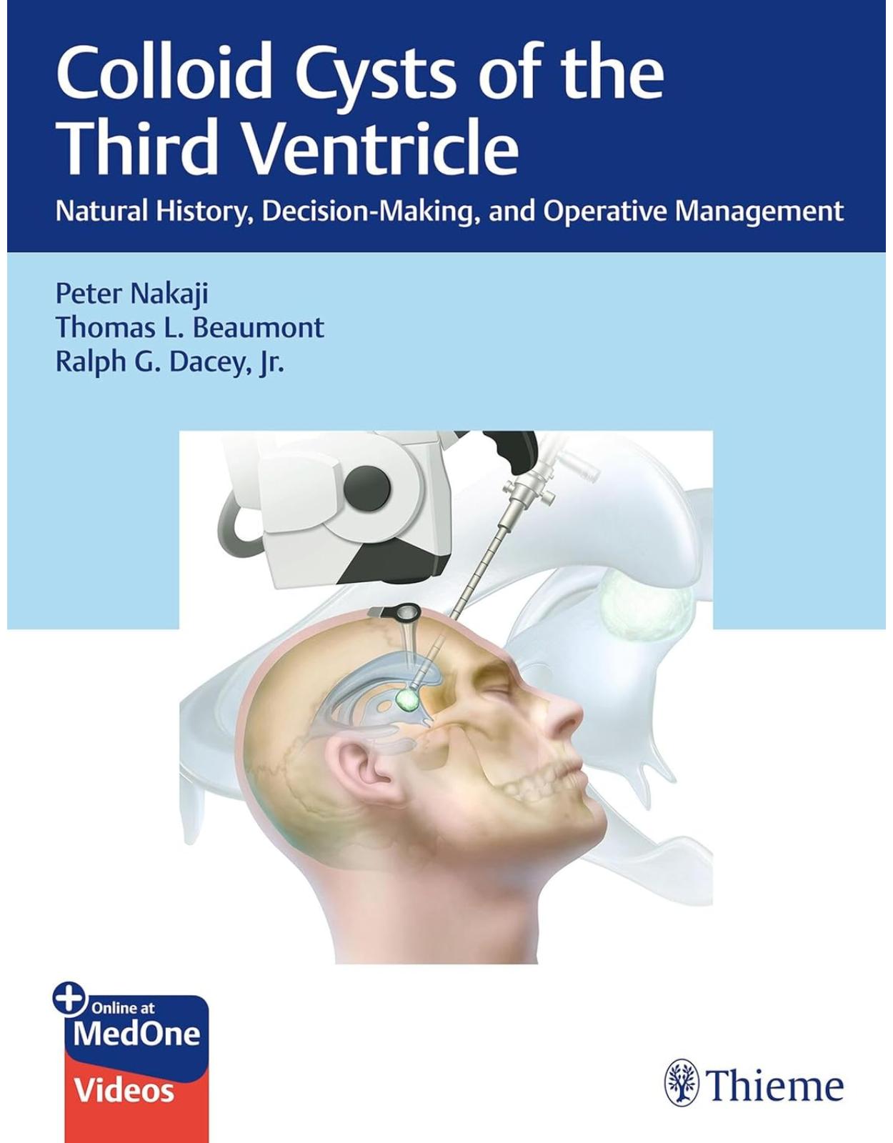 Colloid Cysts of the Third Ventricle: Natural History, Decision-Making, and Operative Management