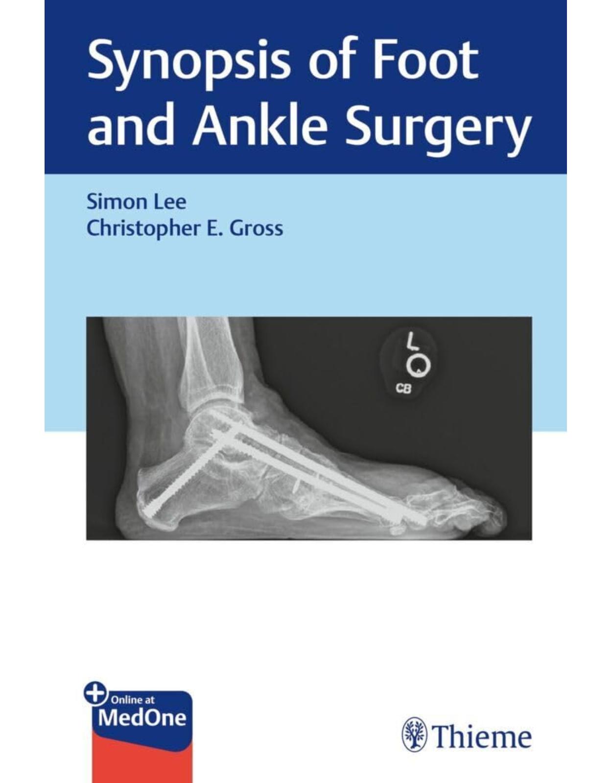 Synopsis of Foot and Ankle Surgery