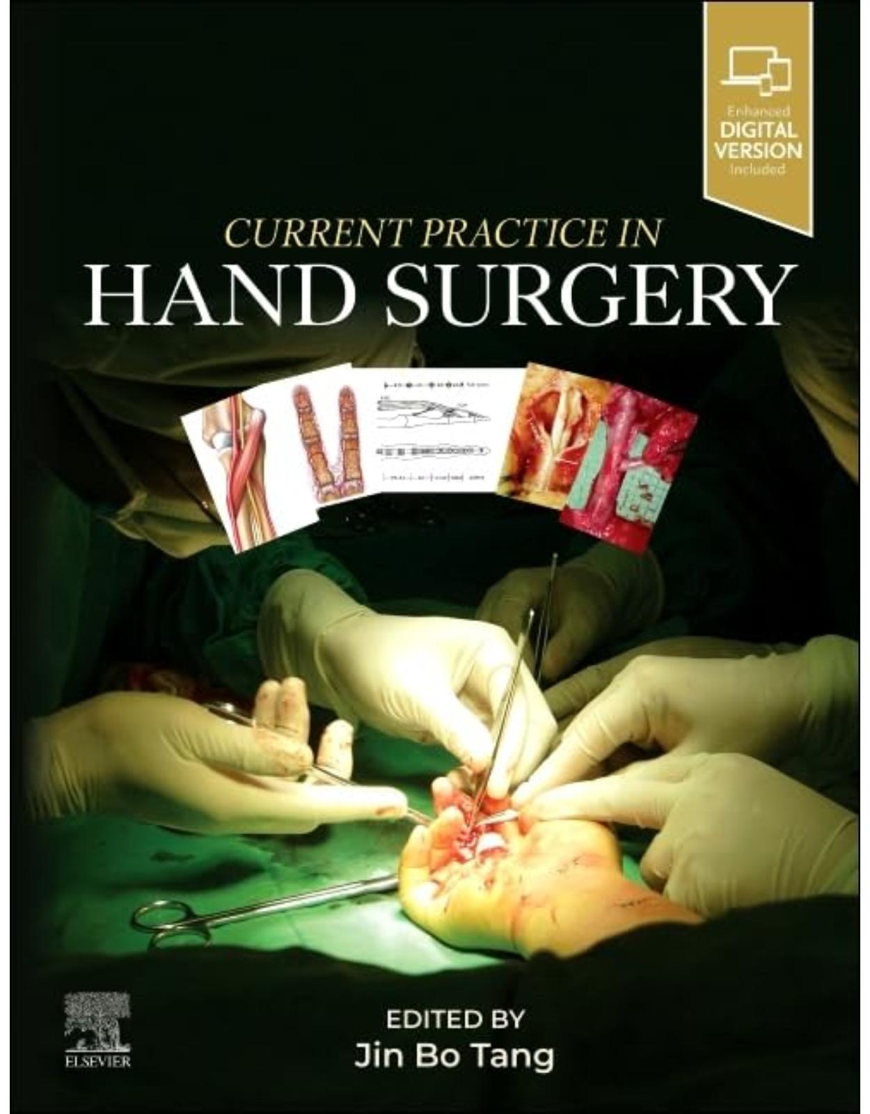 Current Practice in Hand Surgery 