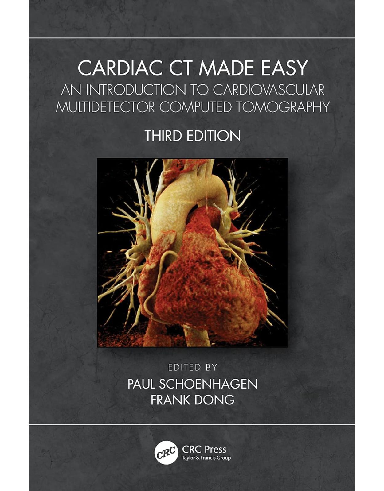 Cardiac CT Made Easy: An Introduction to Cardiovascular Multidetector Computed Tomography