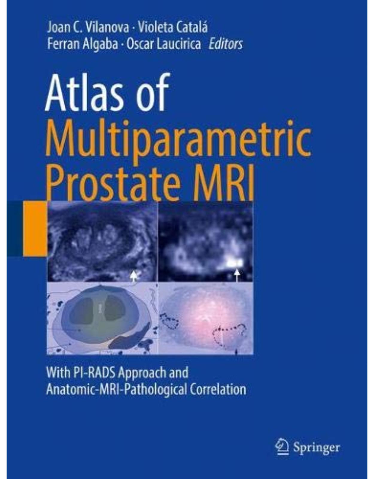 Atlas of Multiparametric Prostate MRI