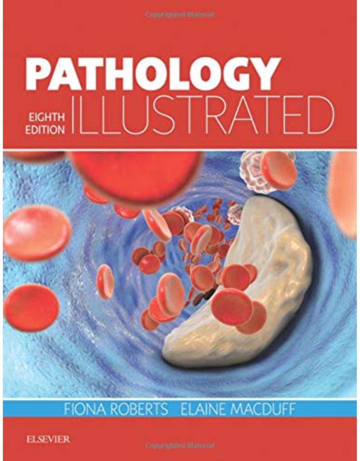 Pathology Illustrated, 8e