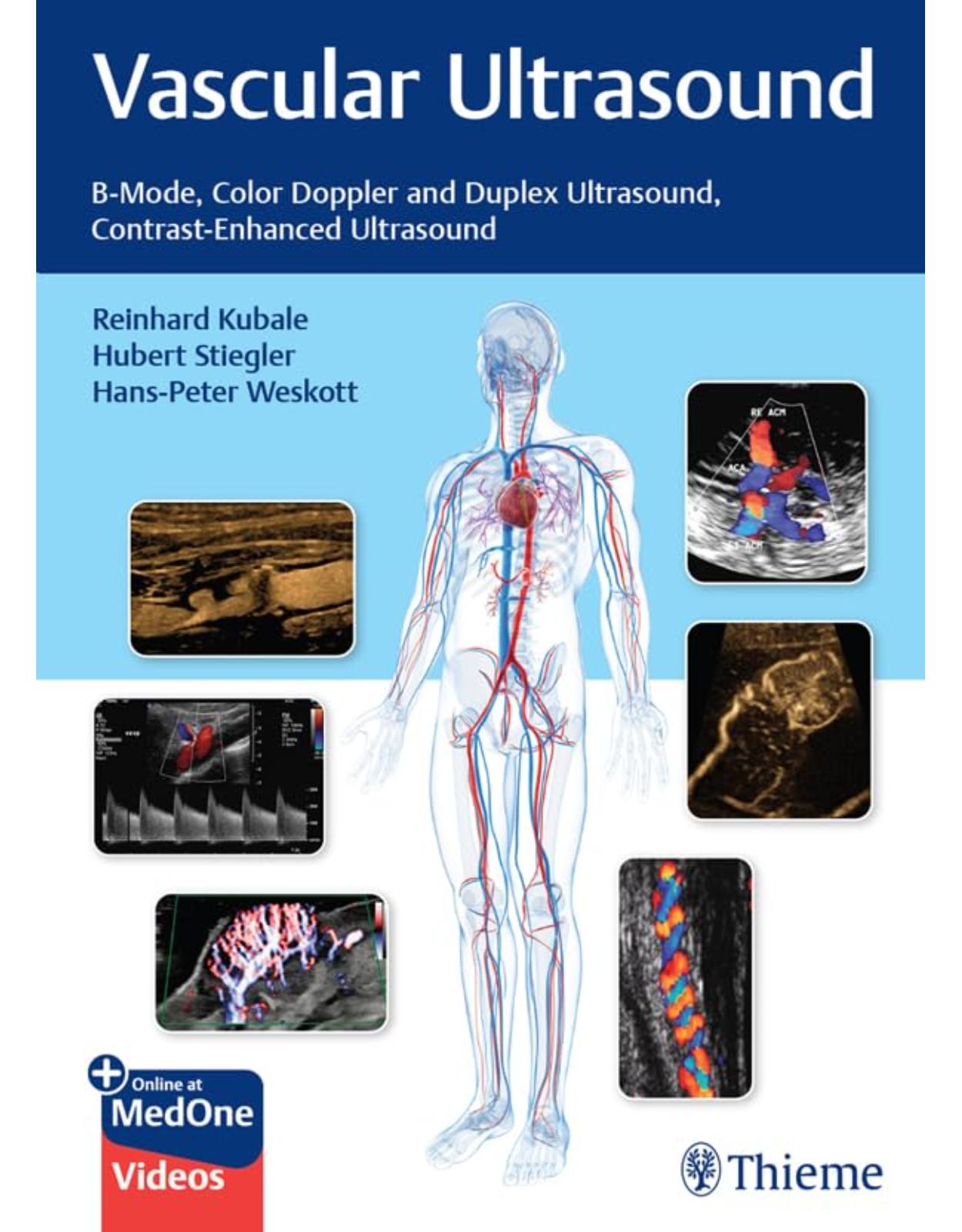 Vascular Ultrasound  BMode, Color Doppler and Duplex Ultrasound, ContrastEnhanced Ultrasound