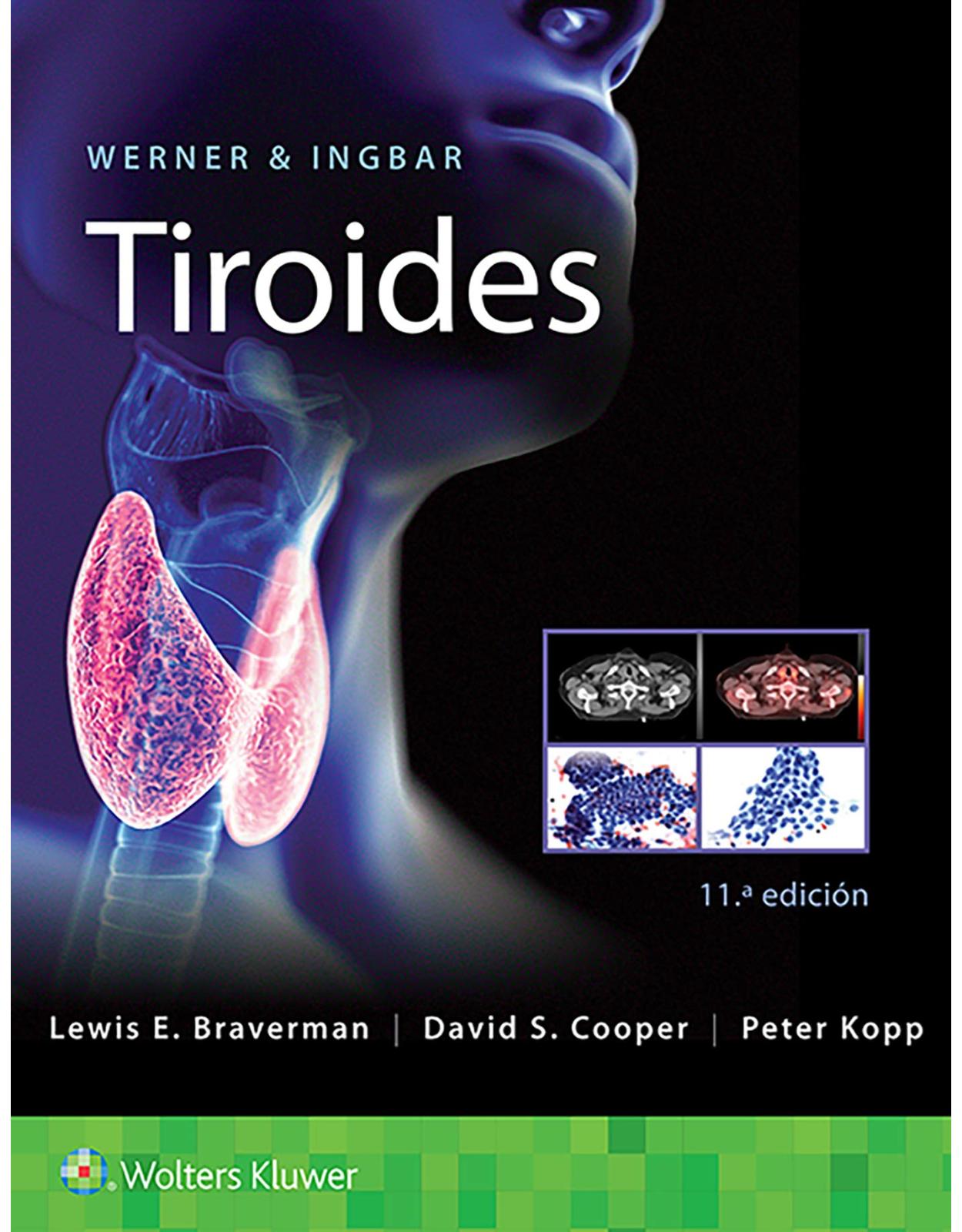 Werner & Ingbar. Tiroides