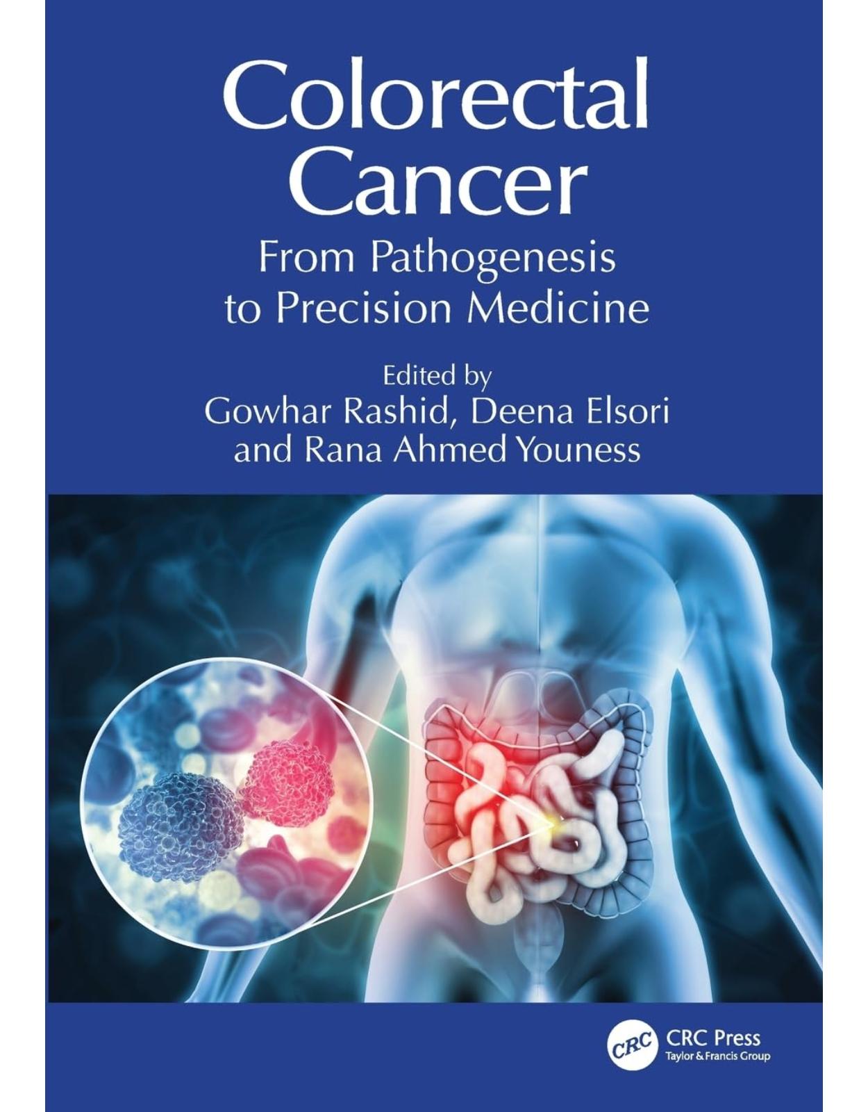 Colorectal Cancer: From Pathogenesis to Precision Medicine